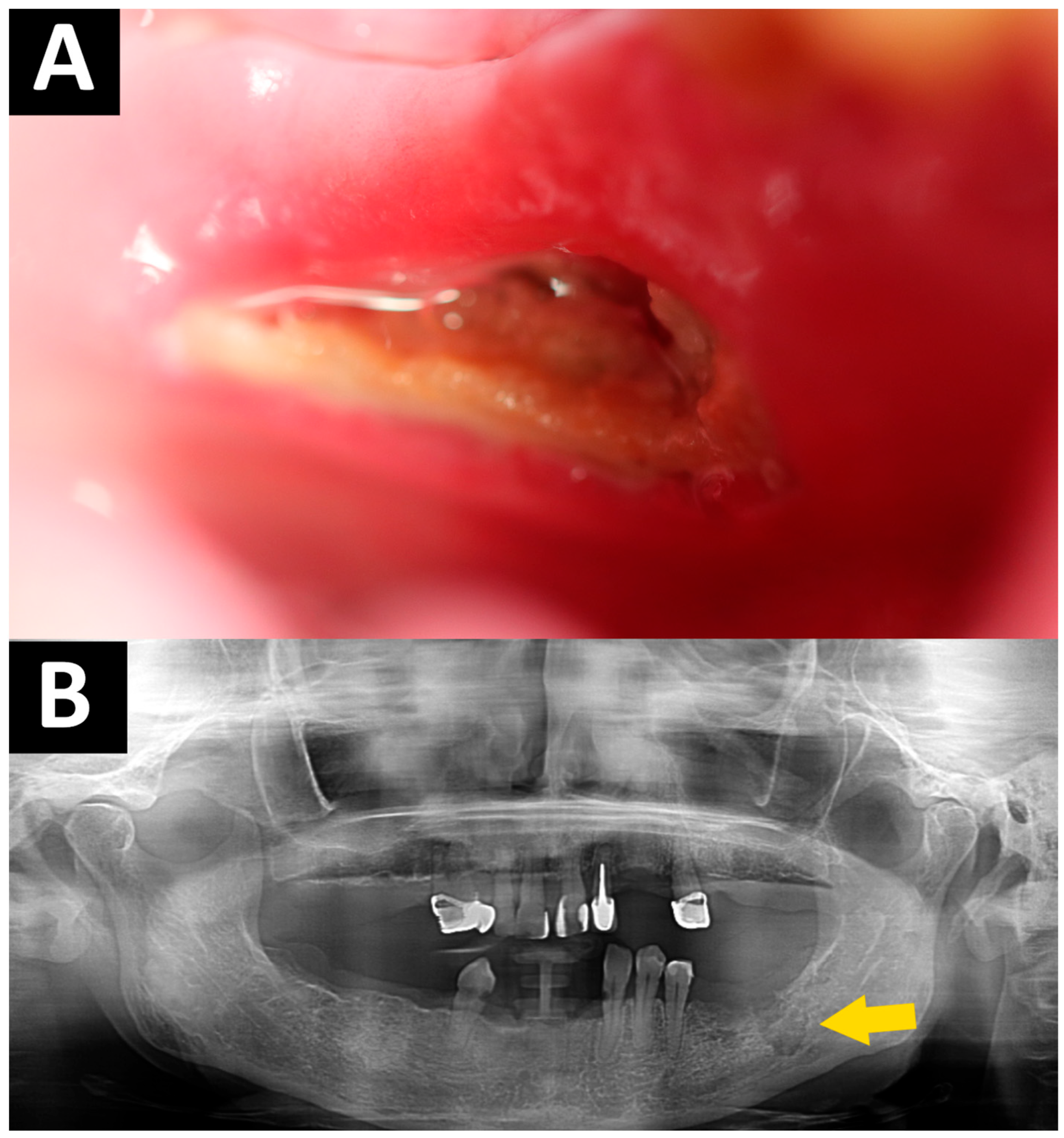 Dentistry 14 00207 g001