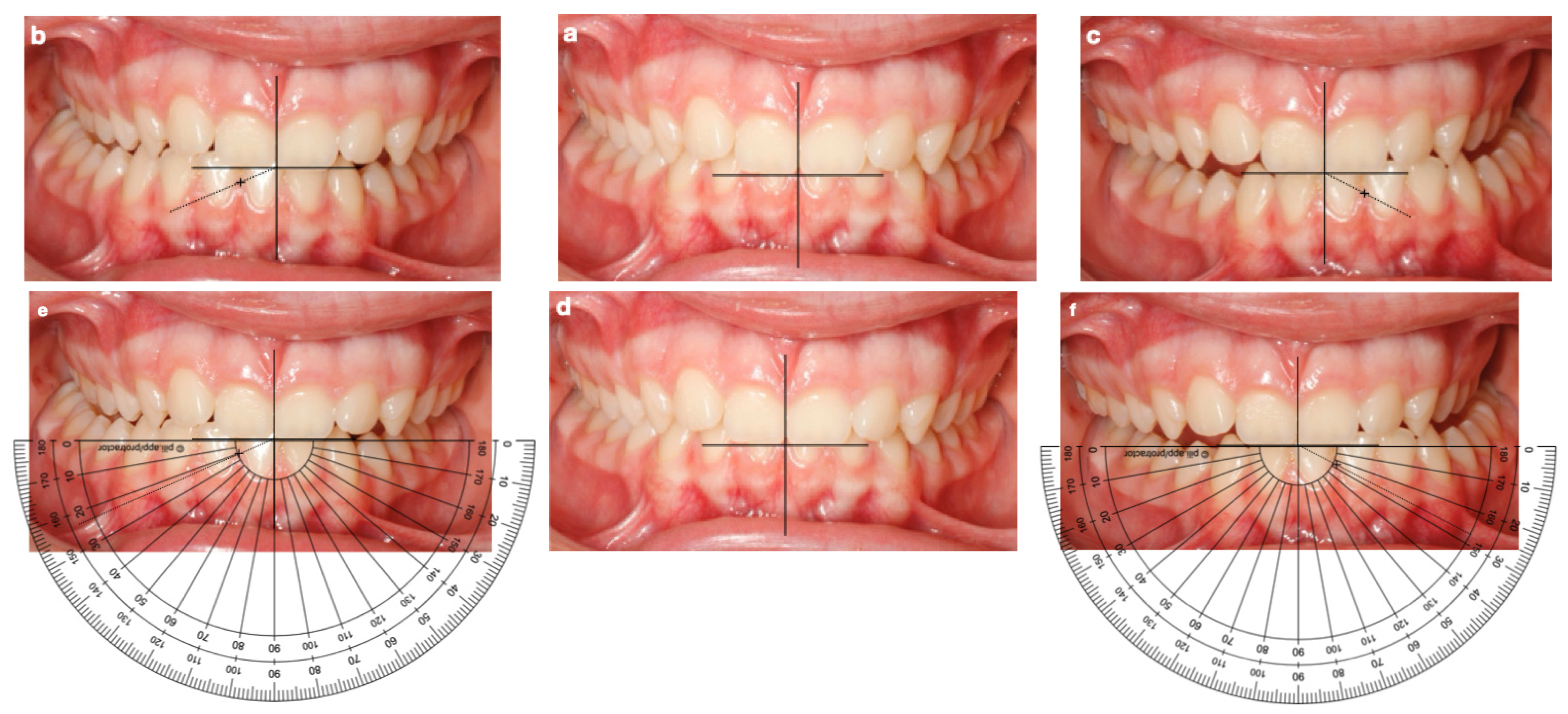 Dentistry 14 00213 g001
