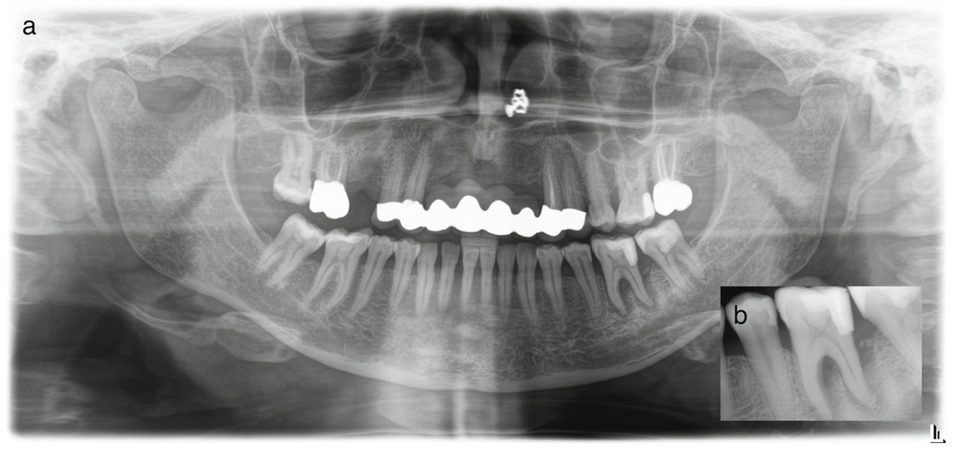 Dentistry 14 00243 g001 Dentistry 14 00243 g001
