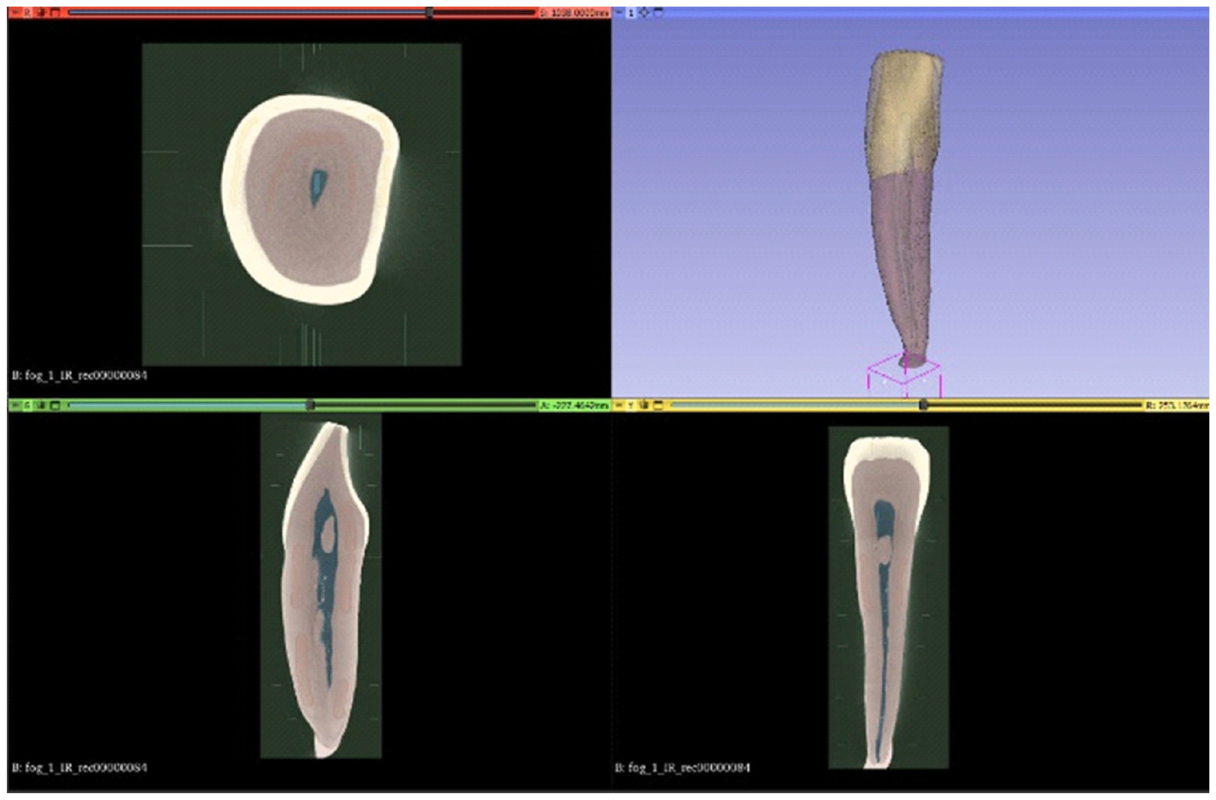 Dentistry 14 00279 g004