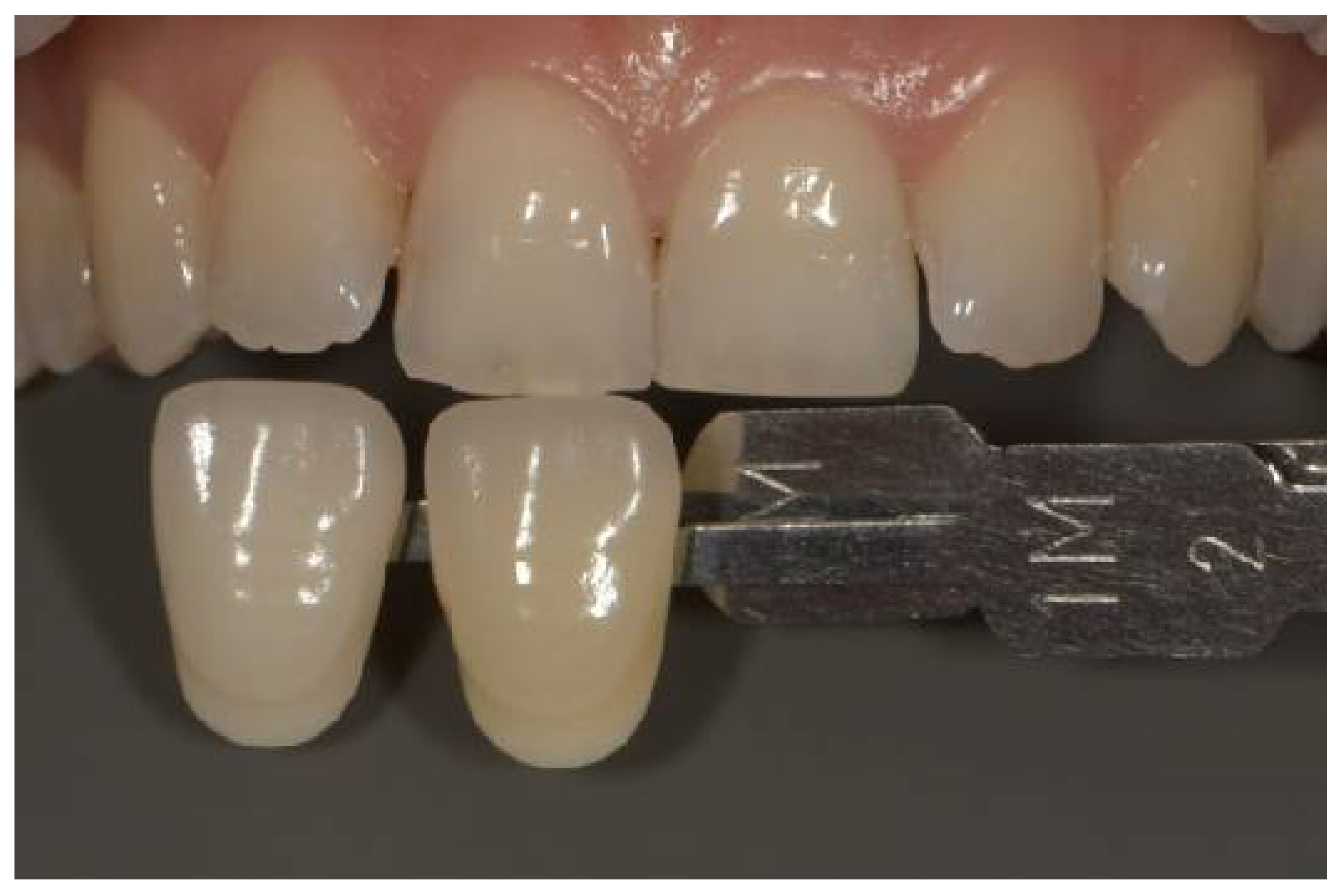 Dentistry 14 00308 g001
