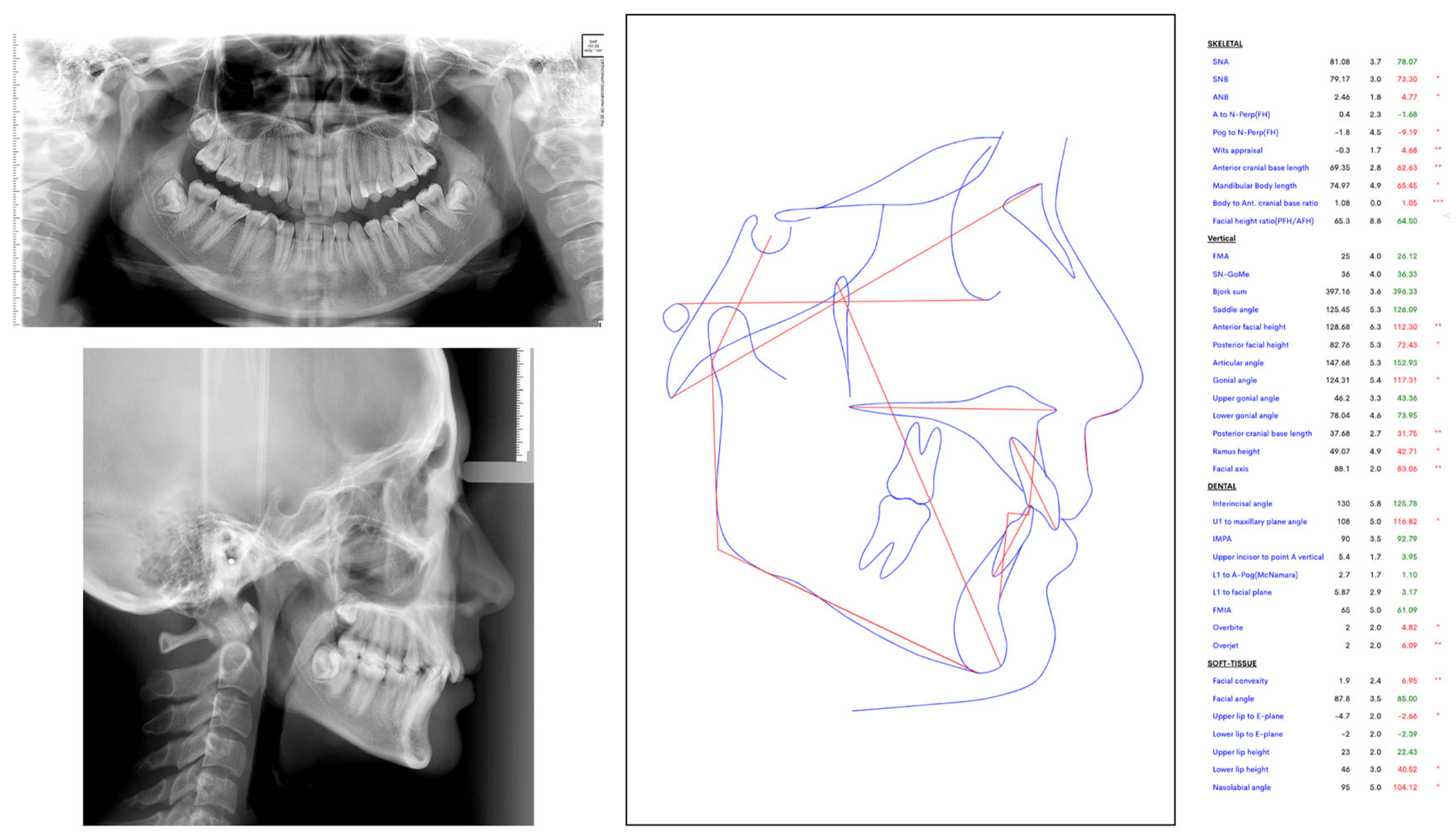 Dentistry 14 00334 g008