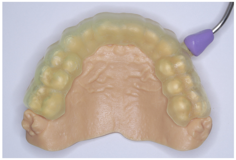 Dentistry 14 00353 g004