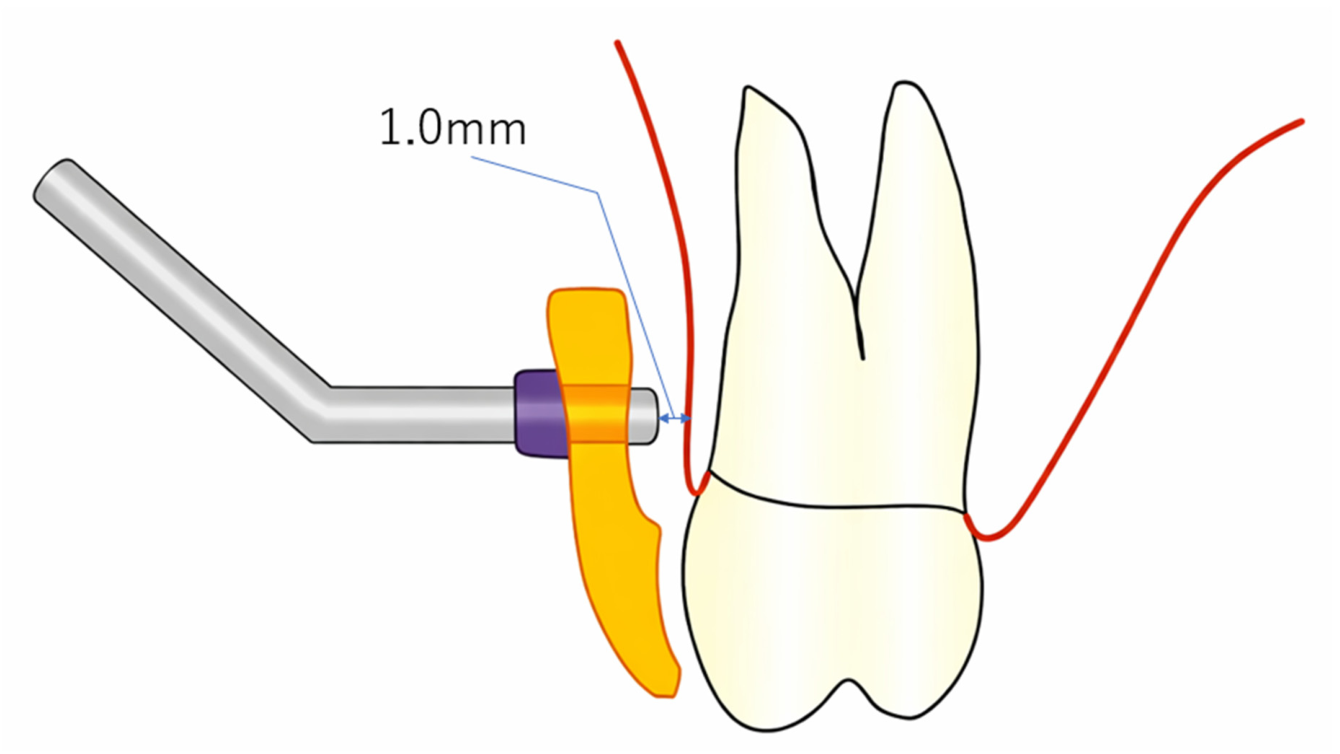 Dentistry 14 00353 g005