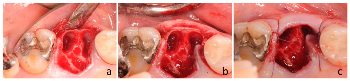 Dentistry 14 00361 g001