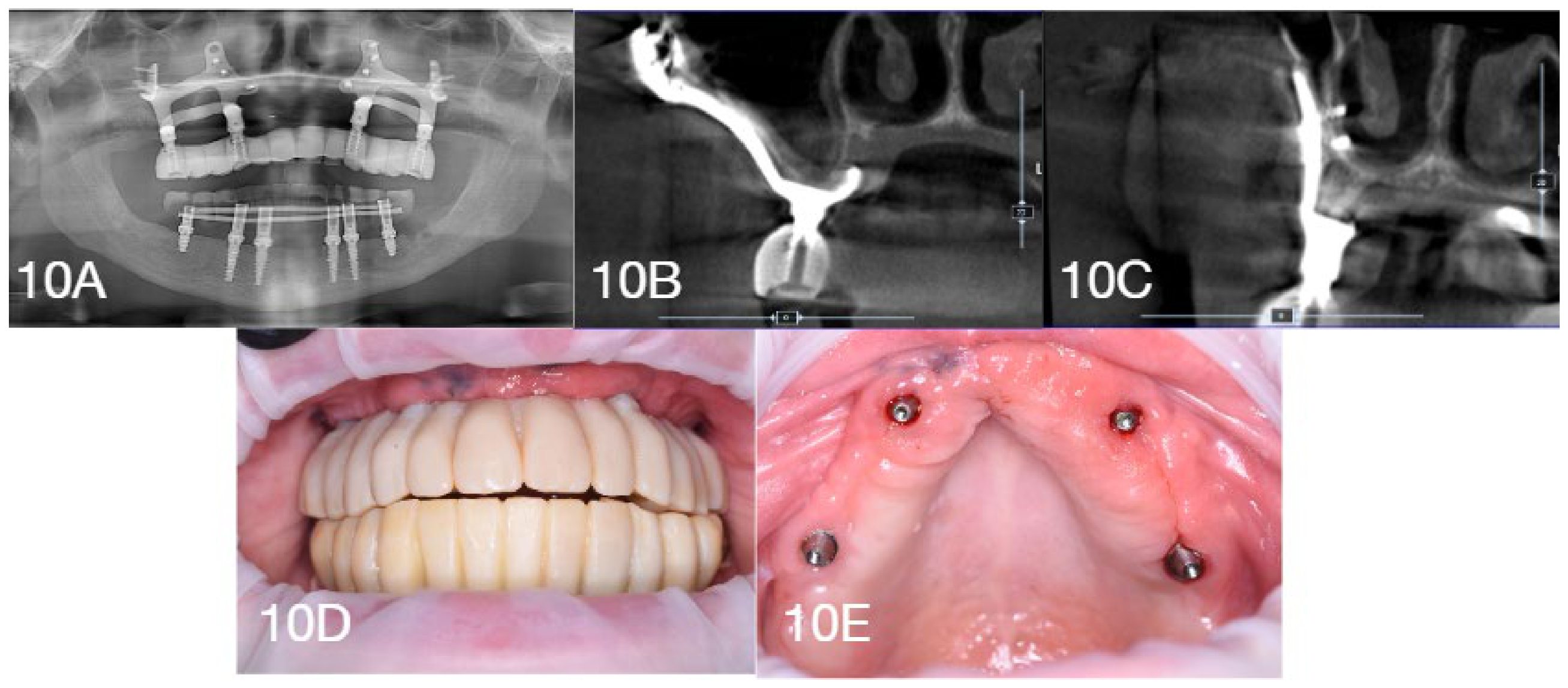 Dentistry 14 00371 g010