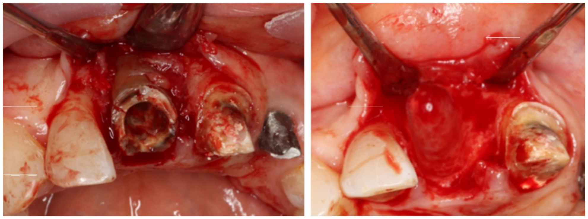 Dentistry 14 00600 g012