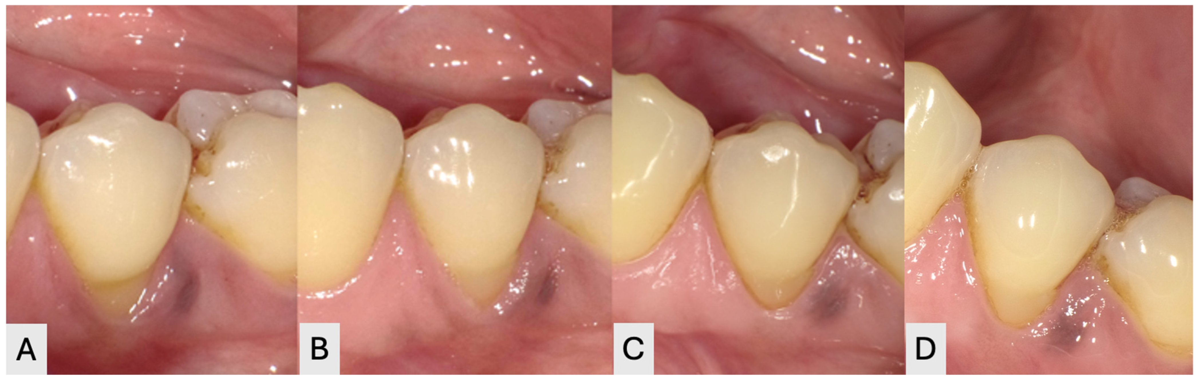 Dentistry 14 00603 g002