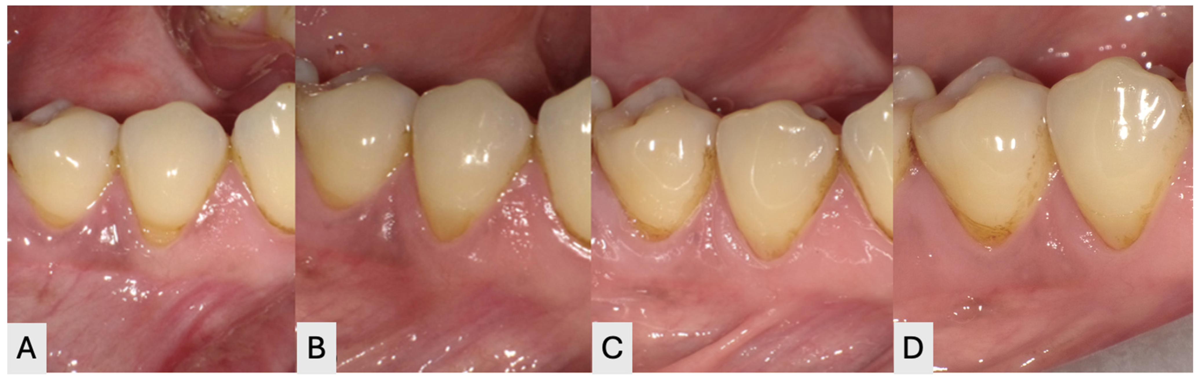 Dentistry 14 00603 g003
