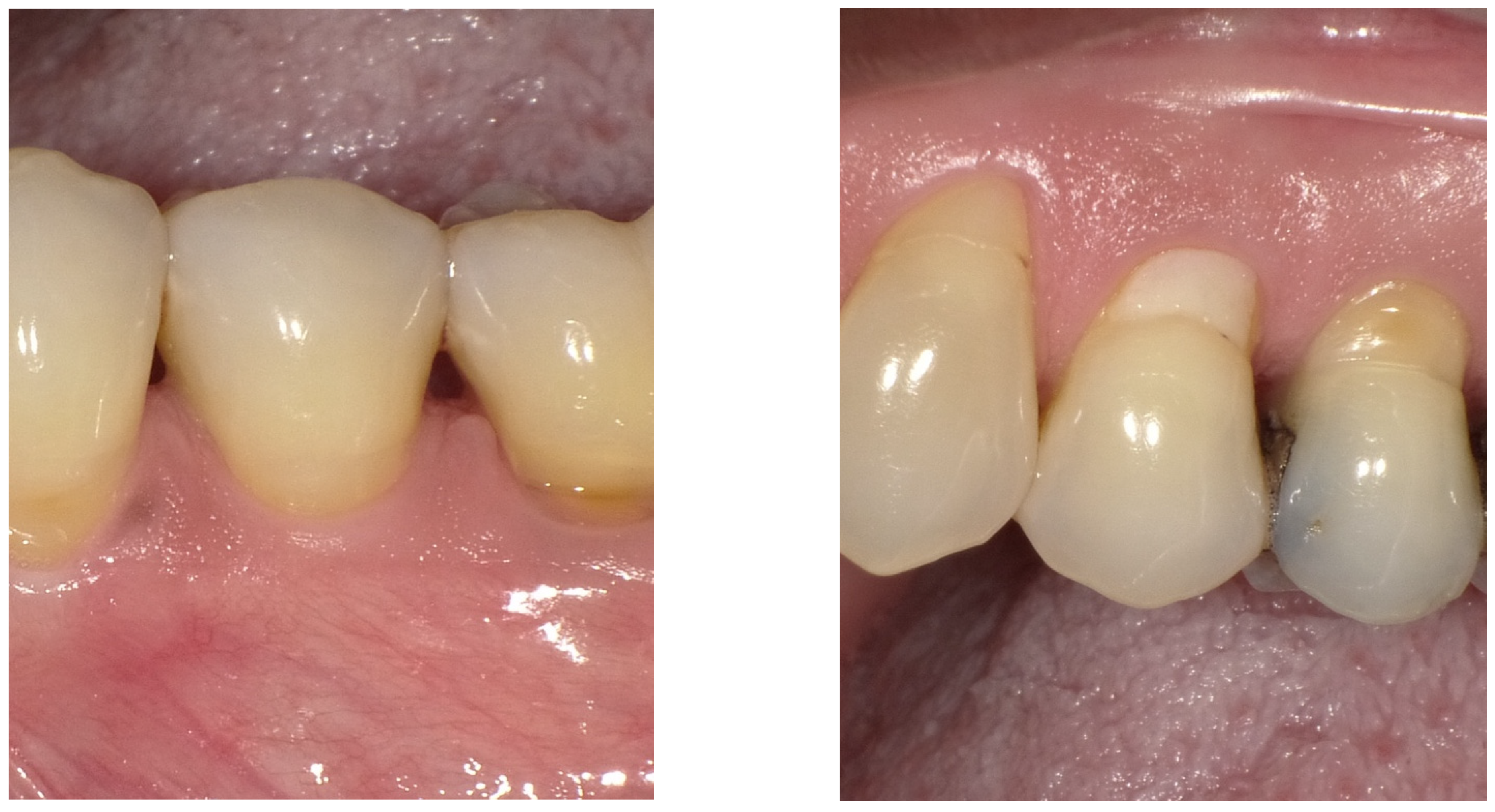 Dentistry 14 00603 g004