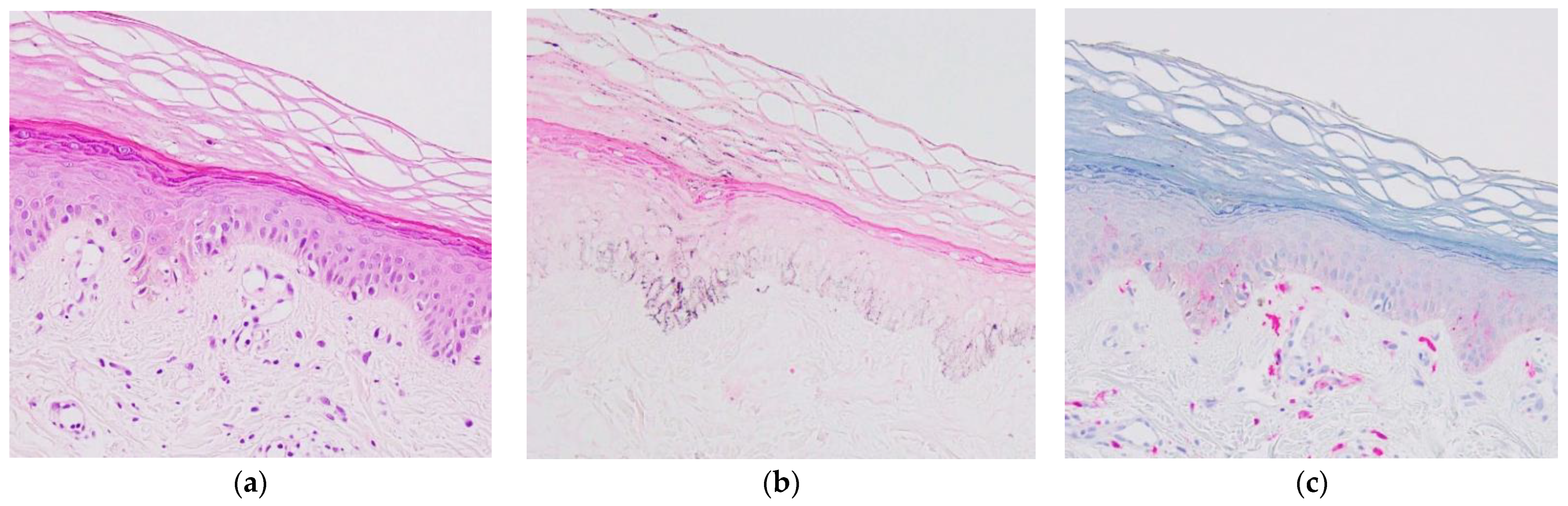 Dermato 01 00004 g002
