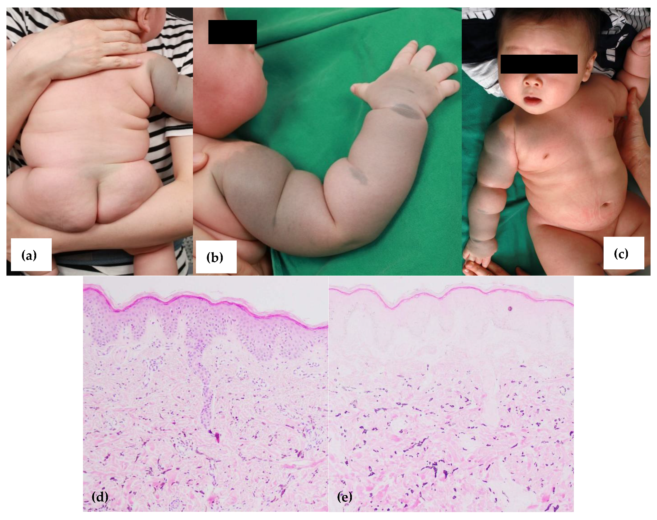 Dermato 01 00006 g002