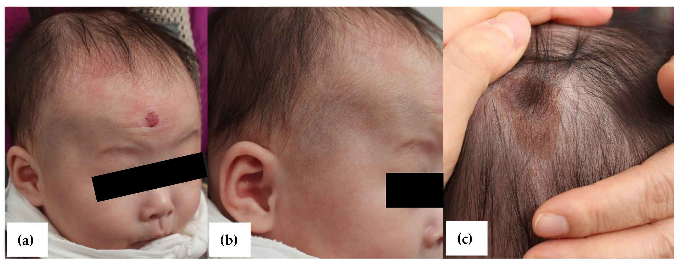 Dermato 01 00006 g003