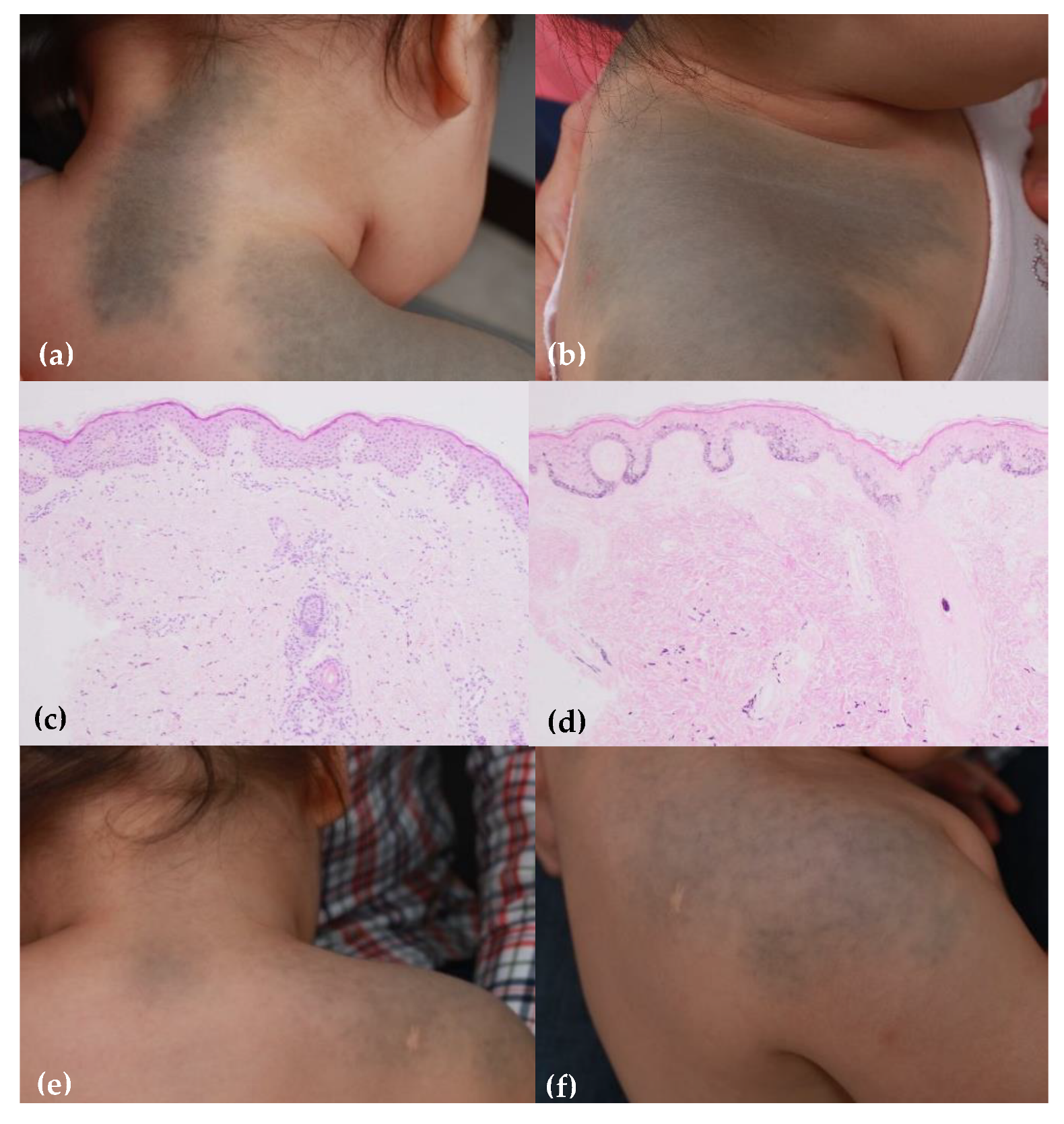 Dermato 01 00006 g004