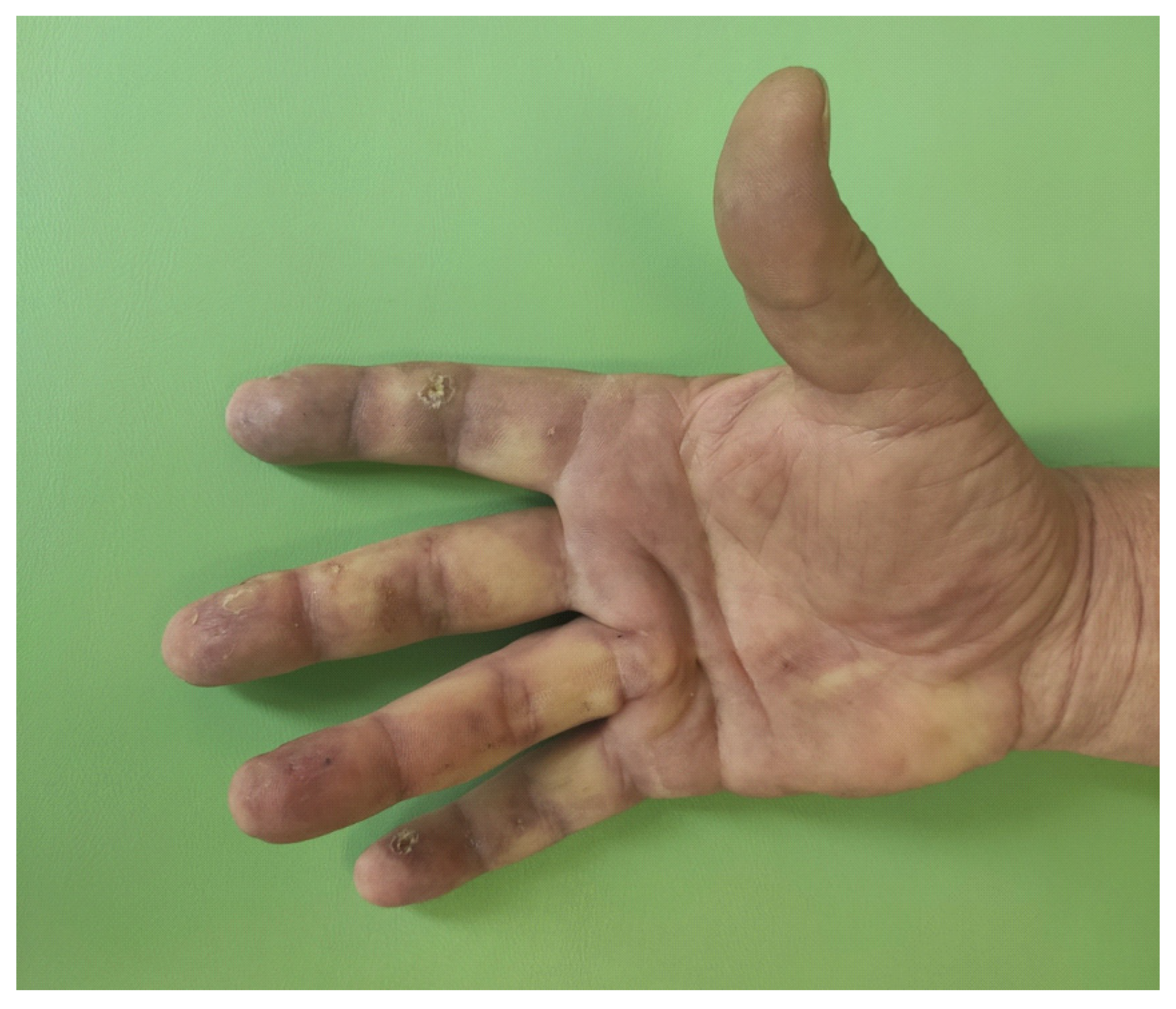 Dermato 01 00009 g001 Dermato 01 00009 g001