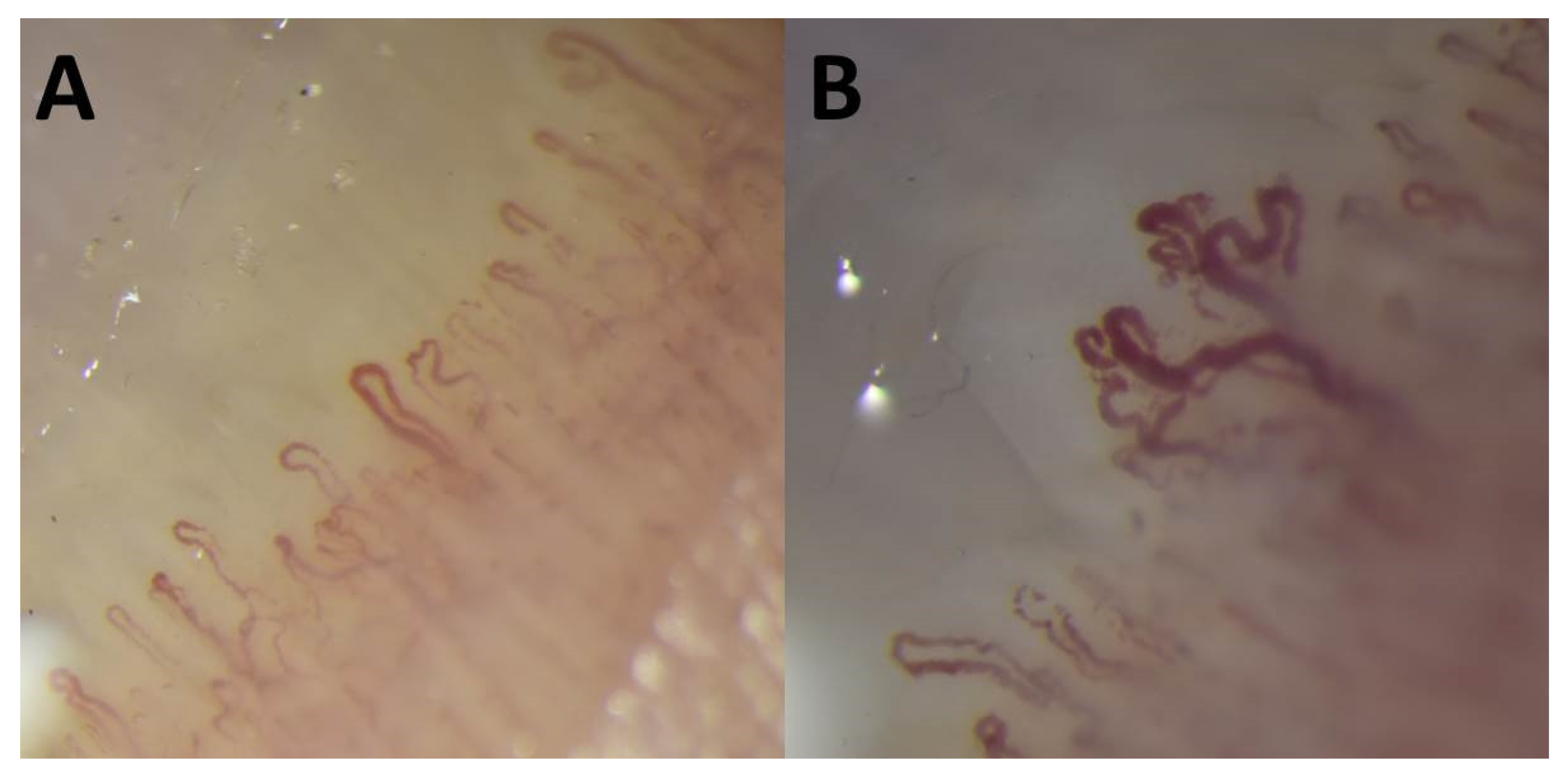 Dermato 01 00009 g002 Dermato 01 00009 g002