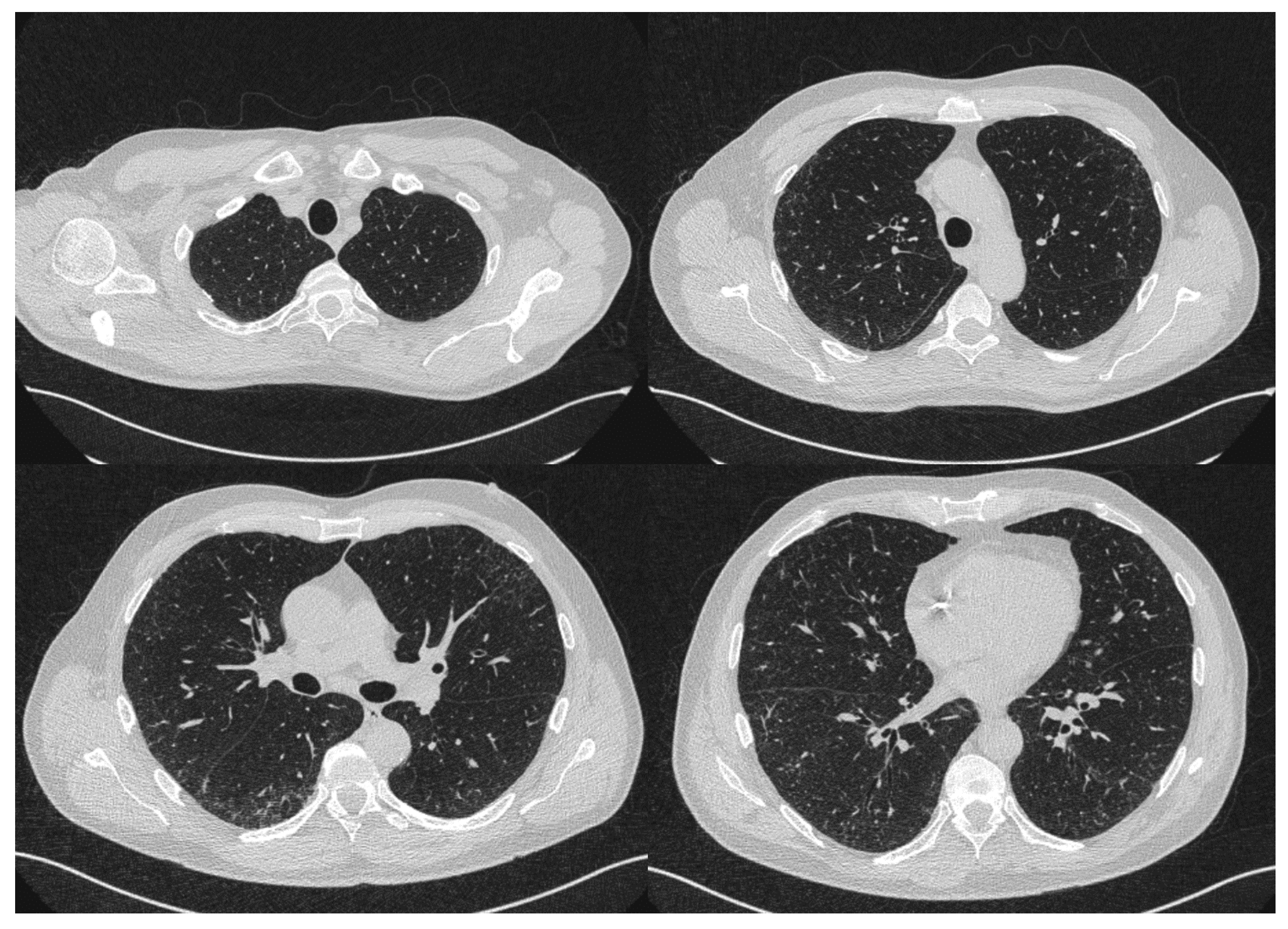 Dermato 01 00009 g003 Dermato 01 00009 g003