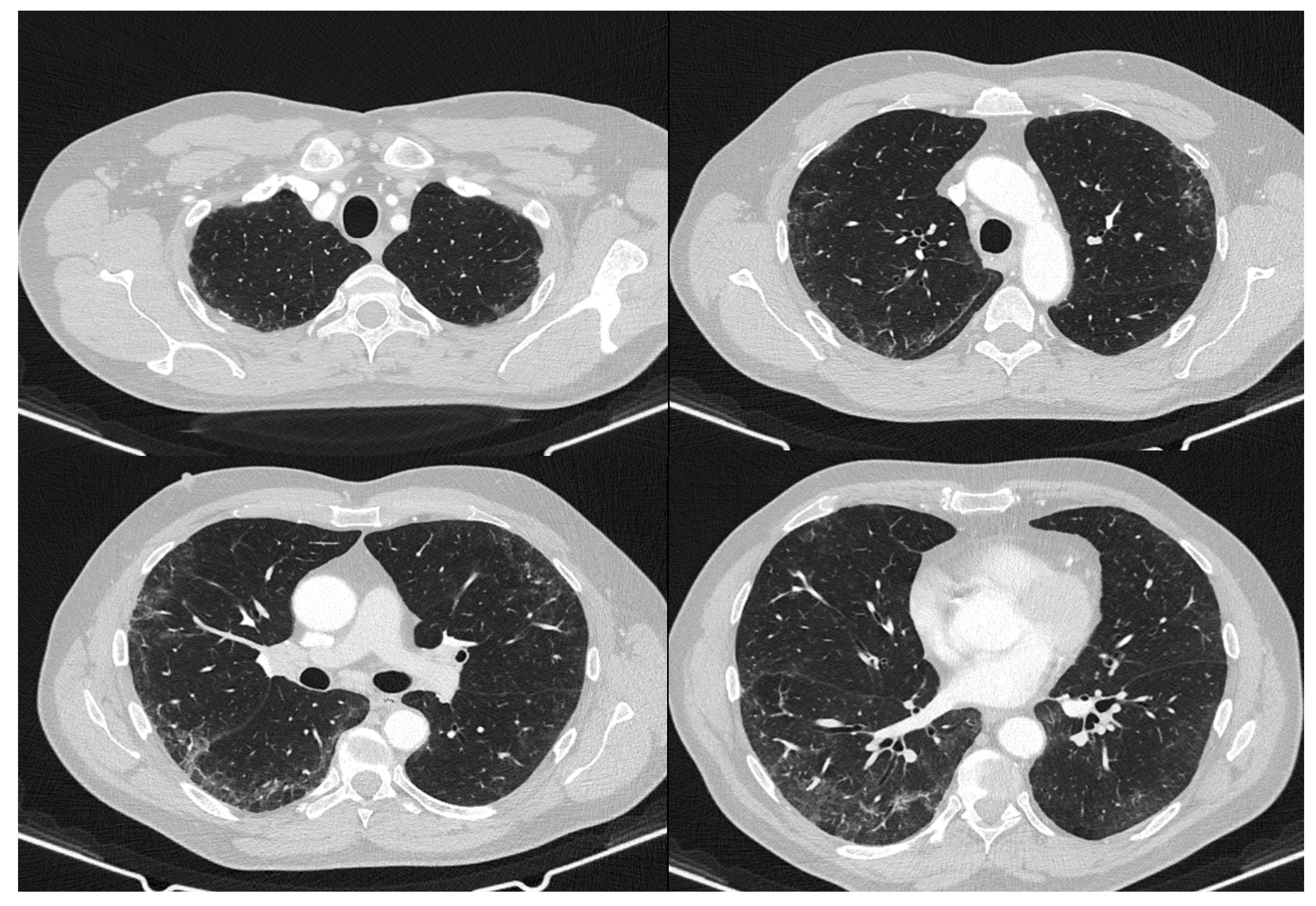 Dermato 01 00009 g005 Dermato 01 00009 g005