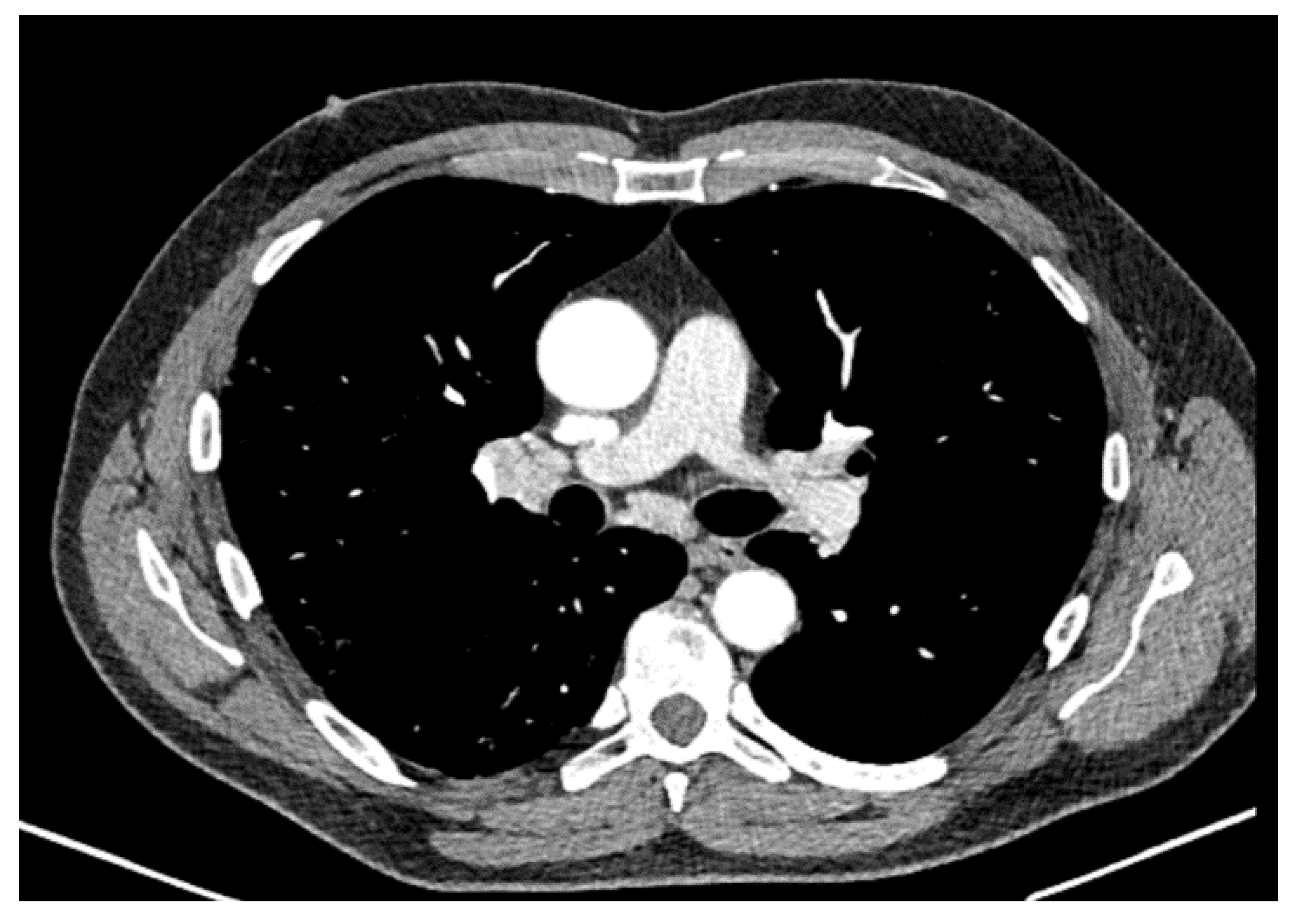 Dermato 01 00009 g006 Dermato 01 00009 g006