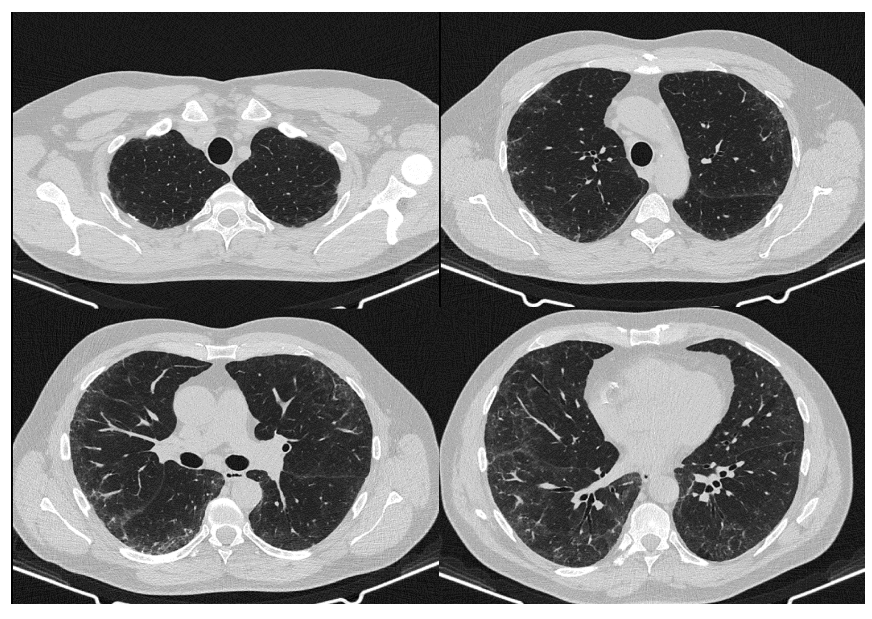 Dermato 01 00009 g008 Dermato 01 00009 g008