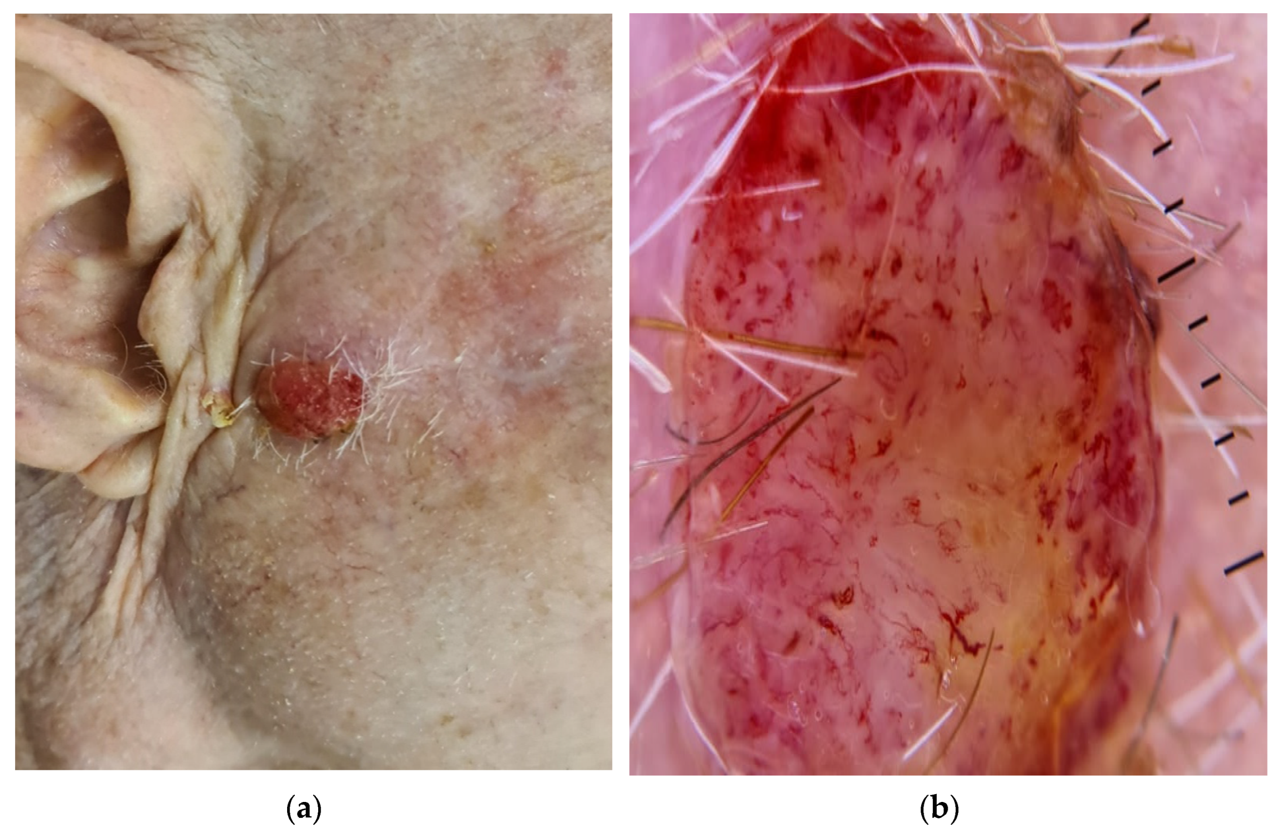 Dermato 02 00007 g001 550