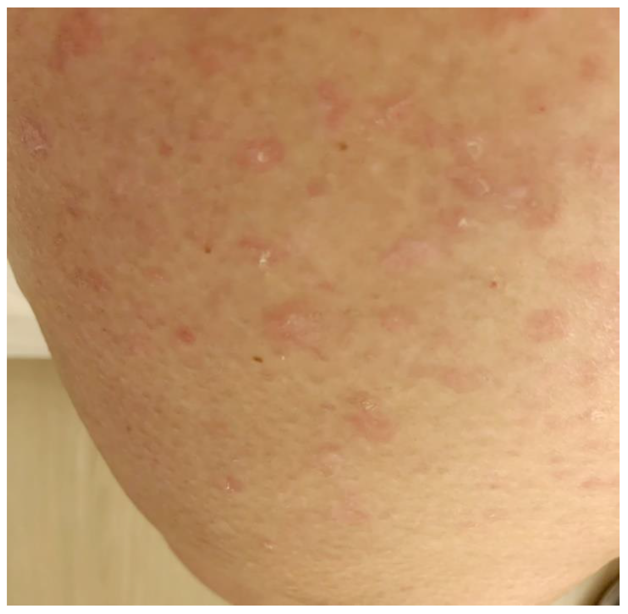 Dermato 02 00011 g001