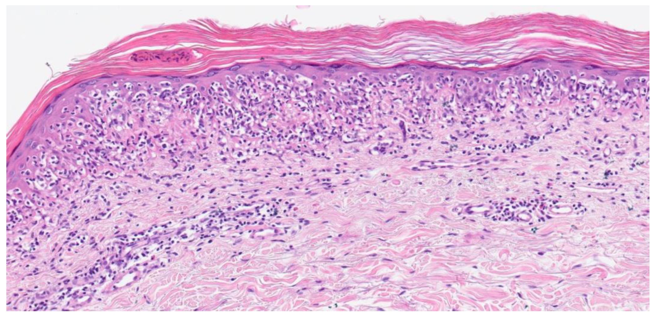 Dermato 02 00011 g002