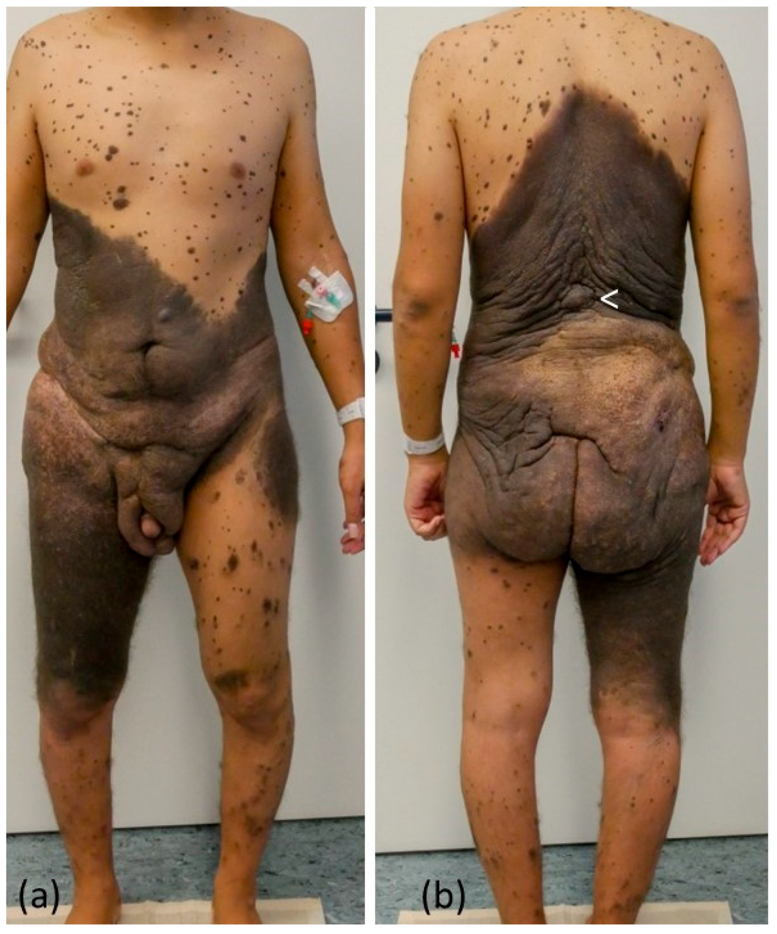 Dermato 03 00004 g001 Dermato 03 00004 g001