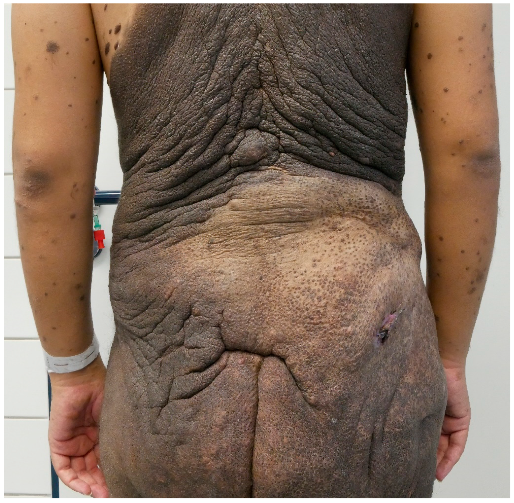 Dermato 03 00004 g002 Dermato 03 00004 g002