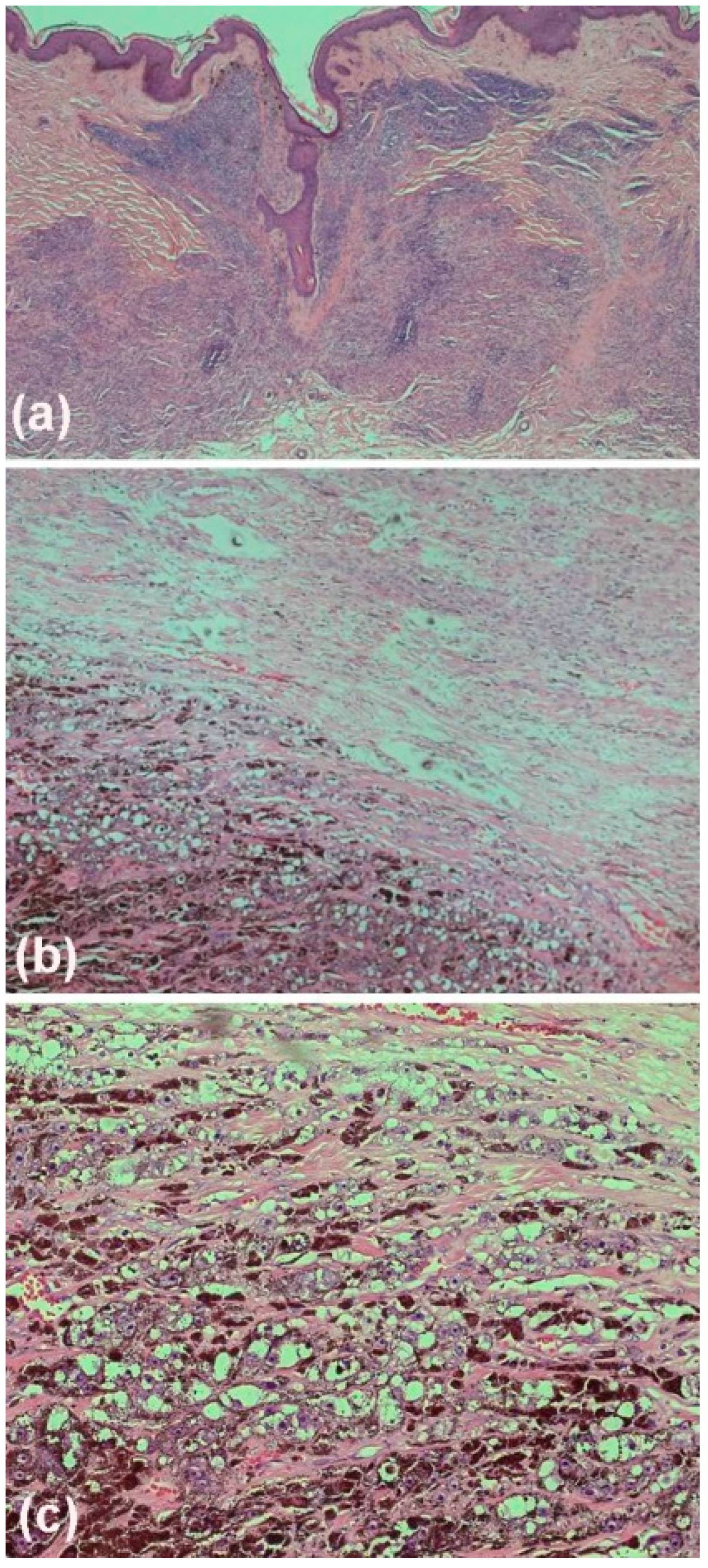 Dermato 03 00004 g003 Dermato 03 00004 g003