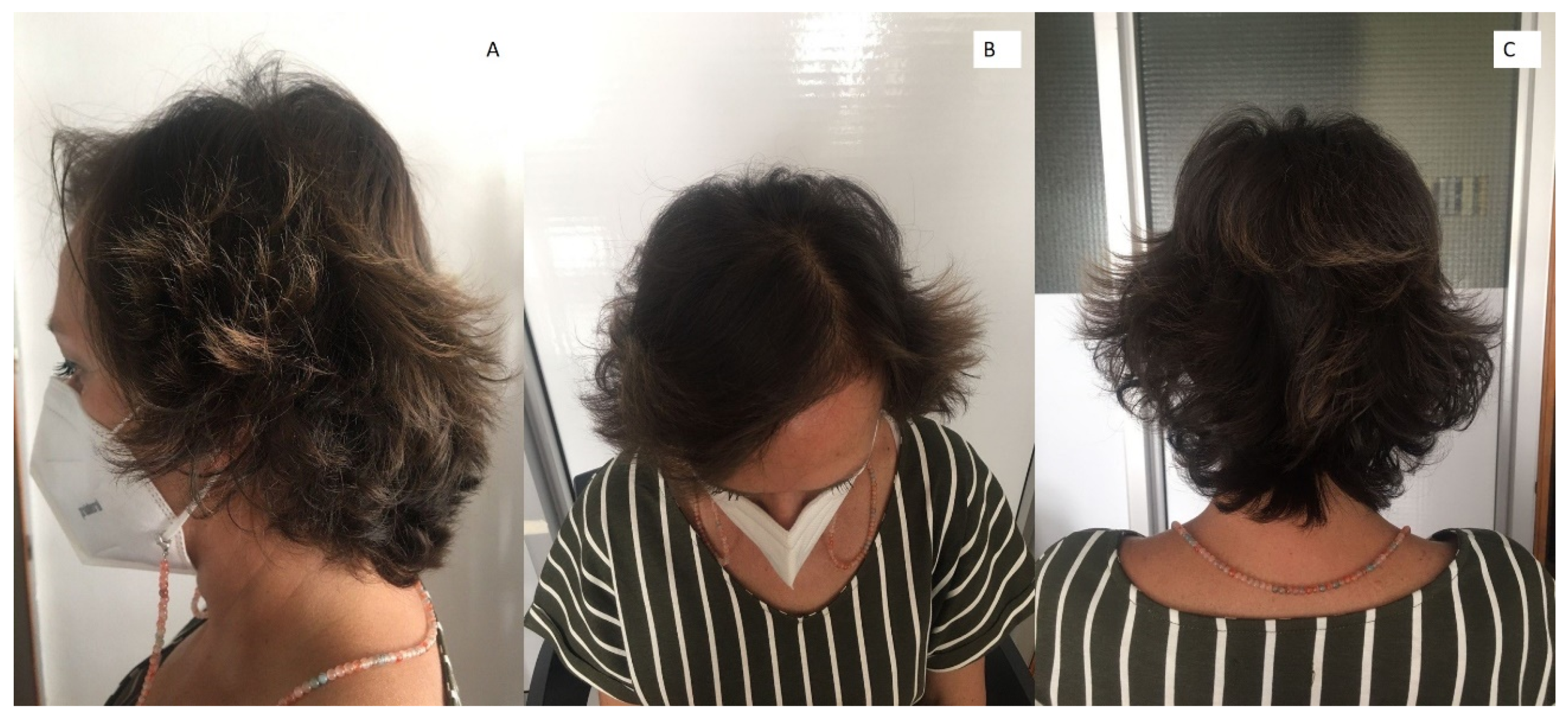 Dermato 03 00009 g002 Dermato 03 00009 g002