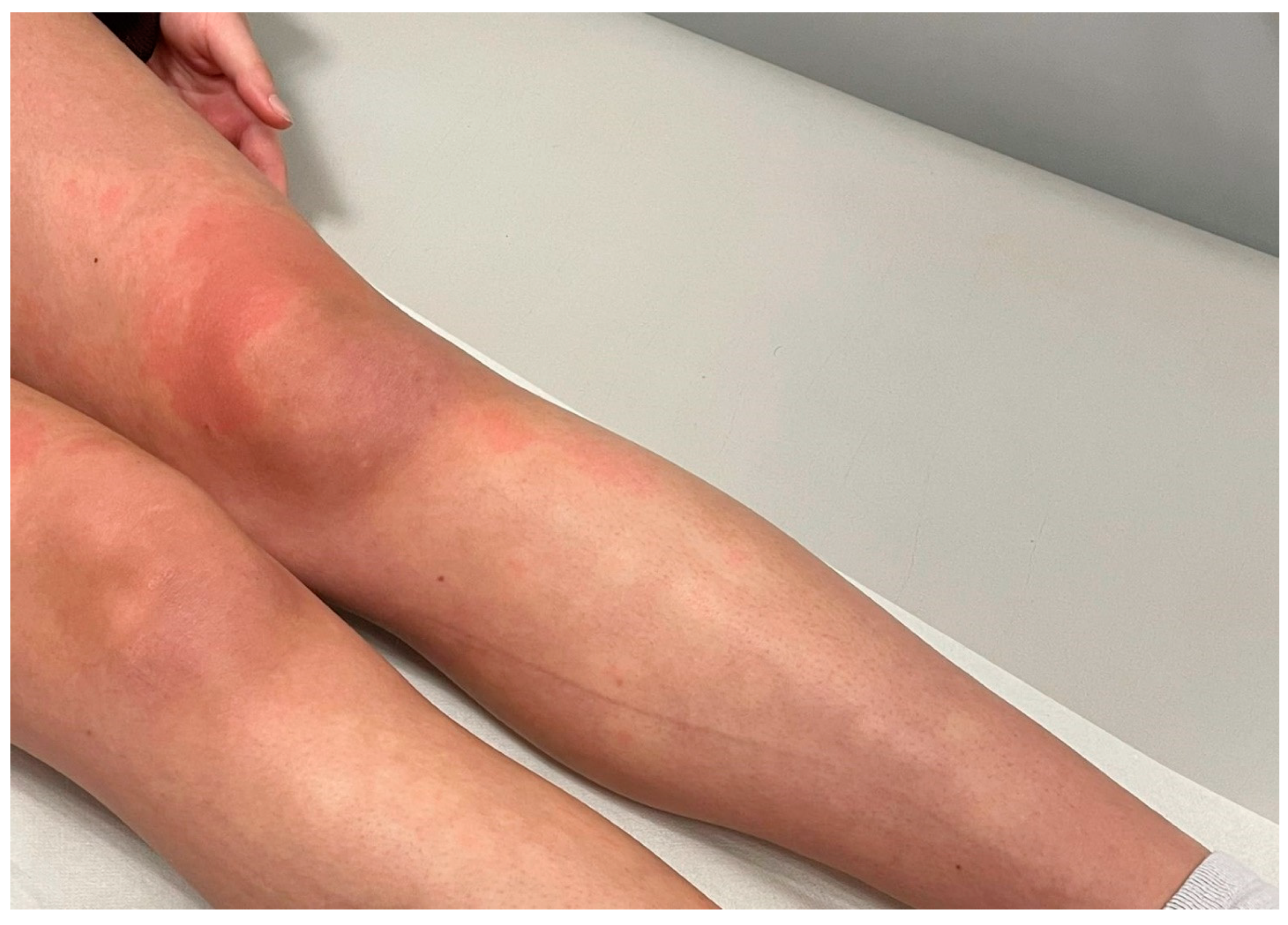 Dermato 03 00015 g002 550