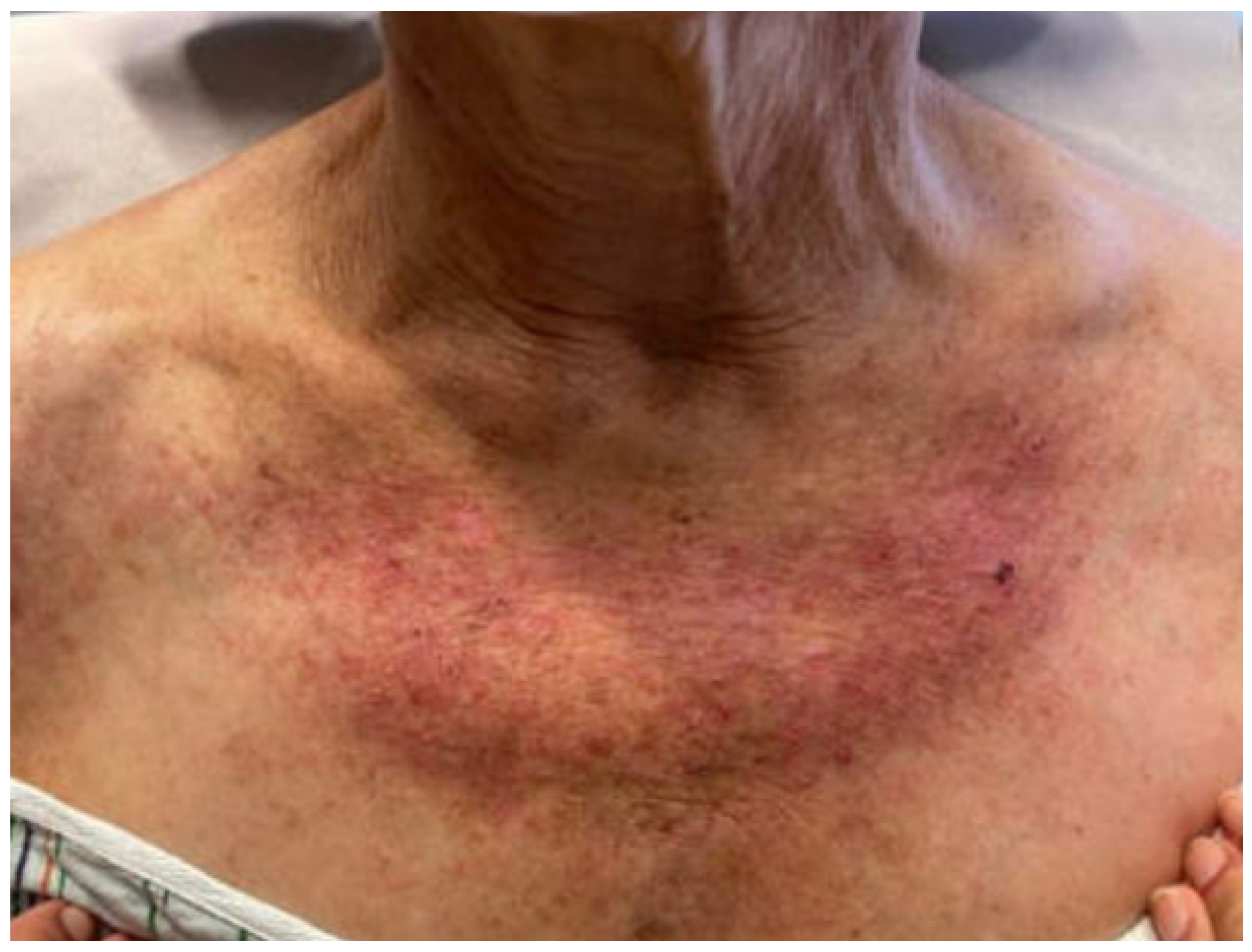 Dermato 03 00018 g001 Dermato 03 00018 g001