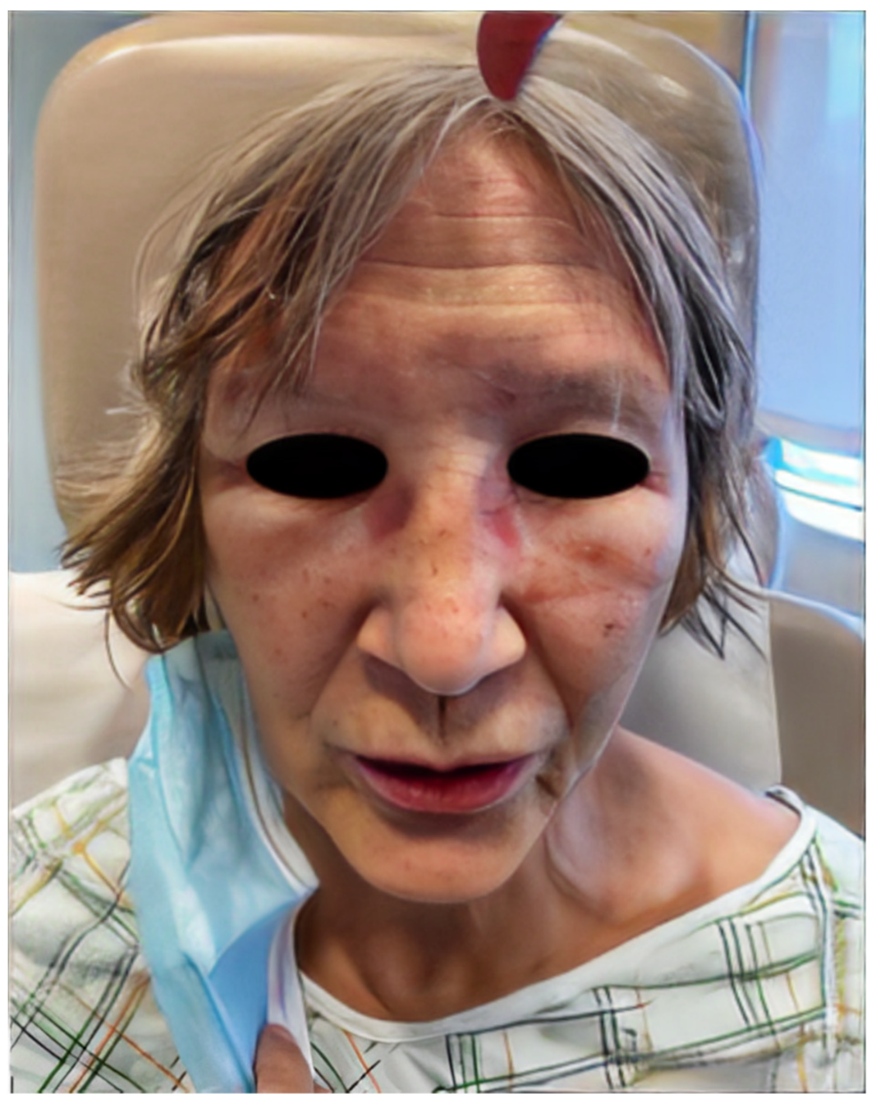 Dermato 03 00018 g002 Dermato 03 00018 g002