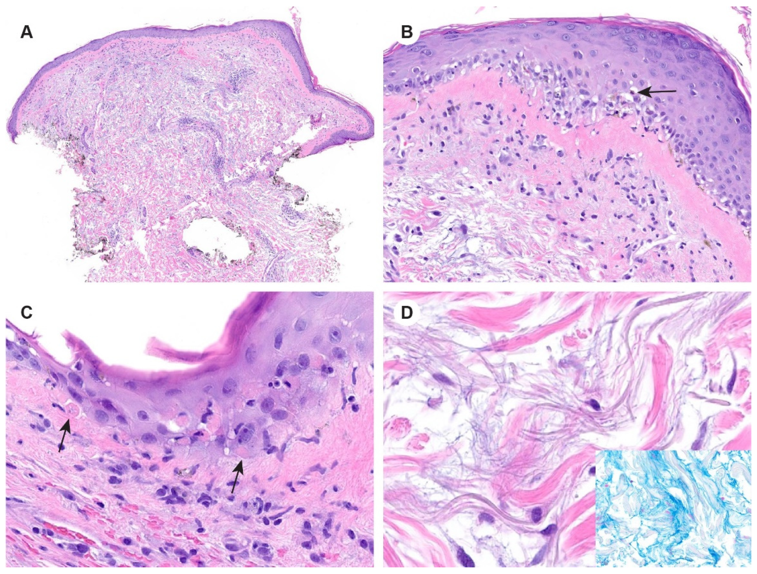 Dermato 03 00018 g004 Dermato 03 00018 g004