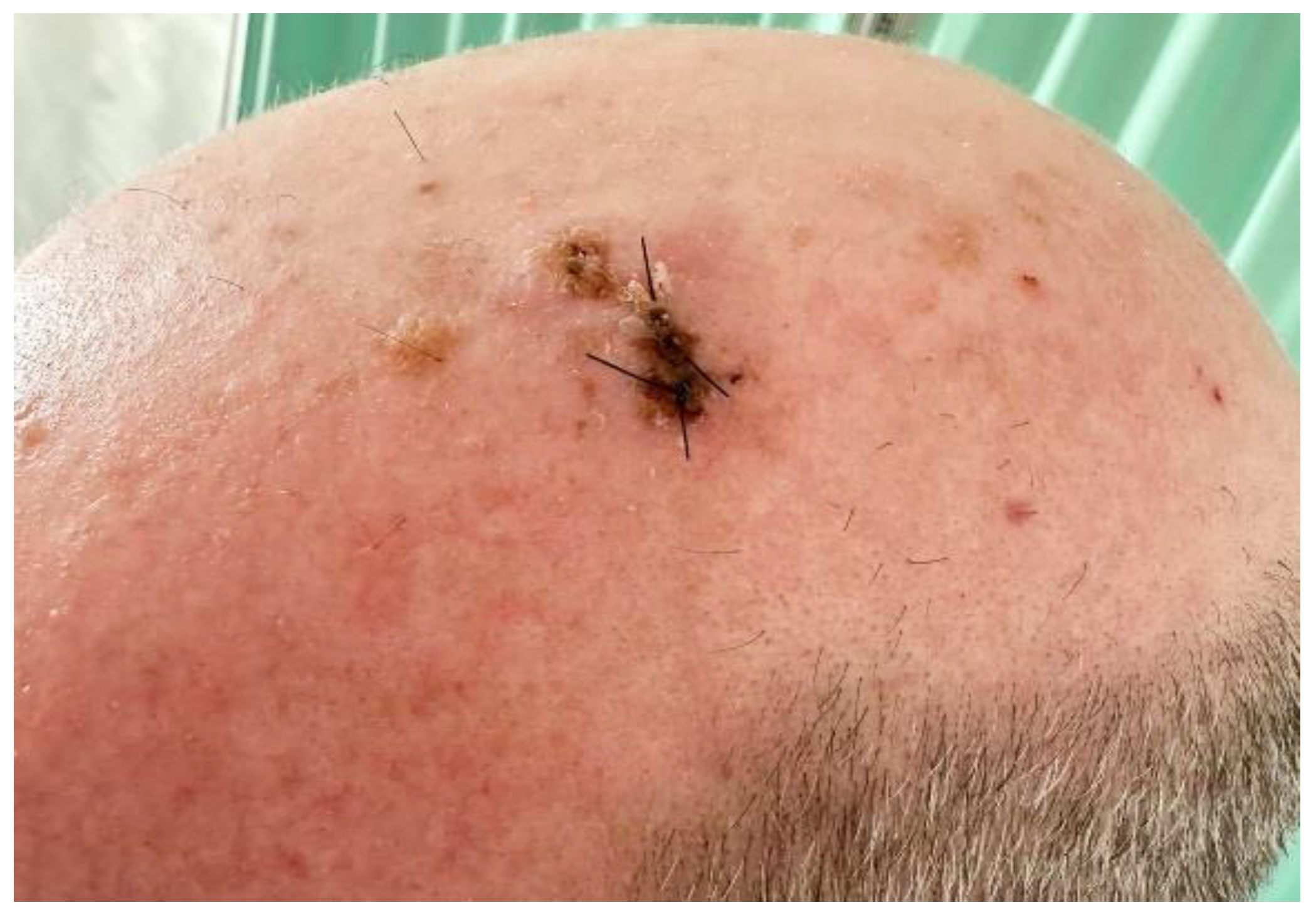 Dermato 03 00020 g001 Dermato 03 00020 g001