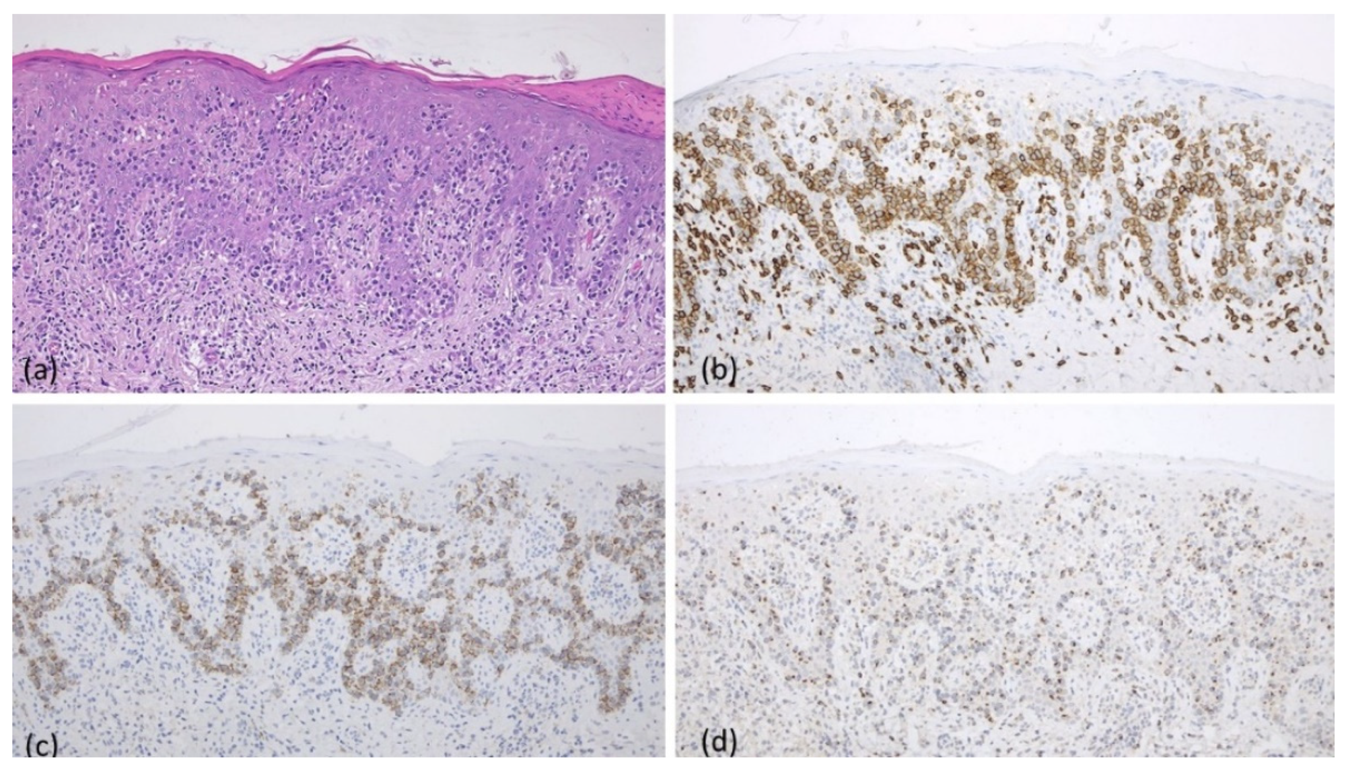 Dermato 04 00001 g002
