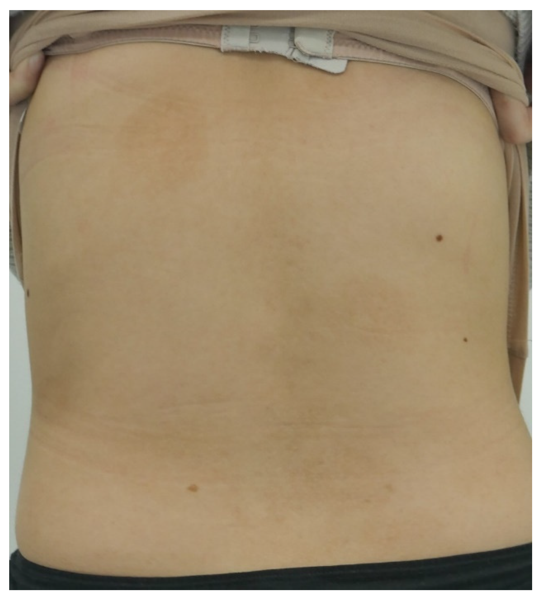 Dermato 04 00001 g003