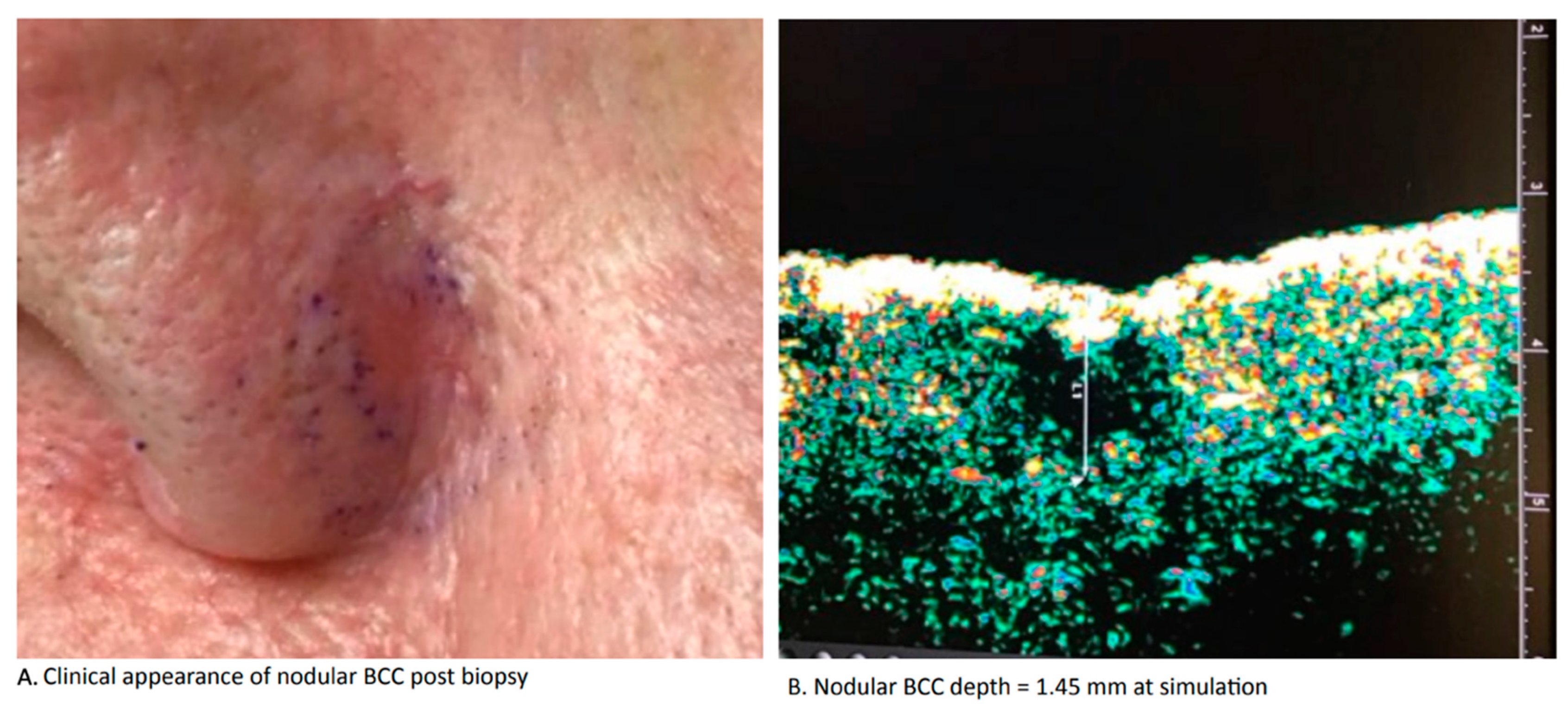 Dermato 04 00010 g001