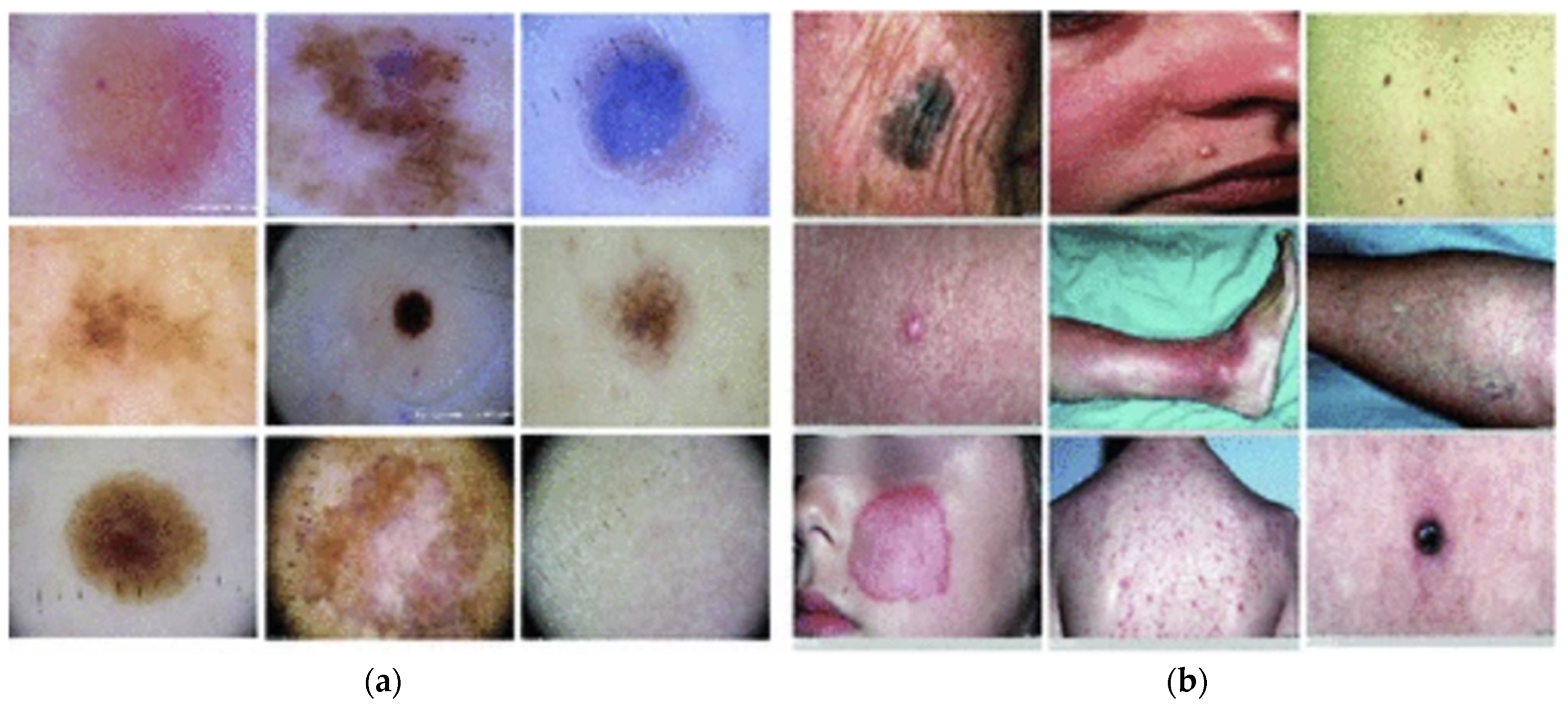 Dermato 04 00011 g002