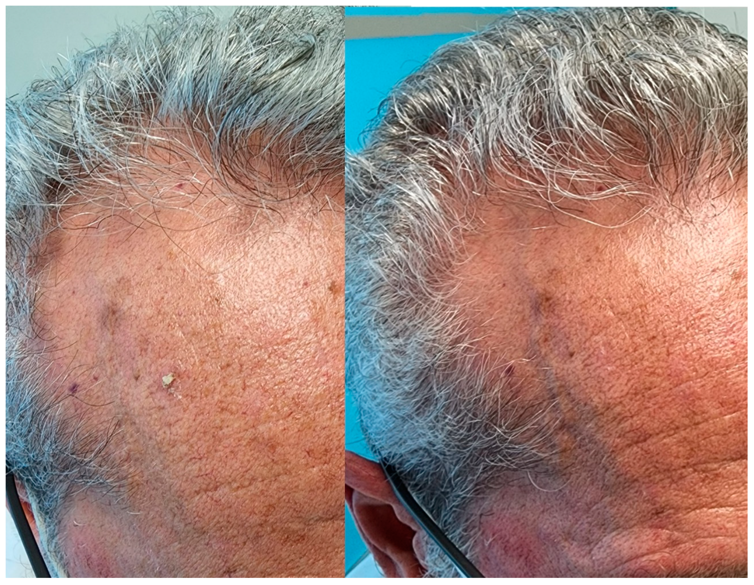 Dermato 05 00002 g001