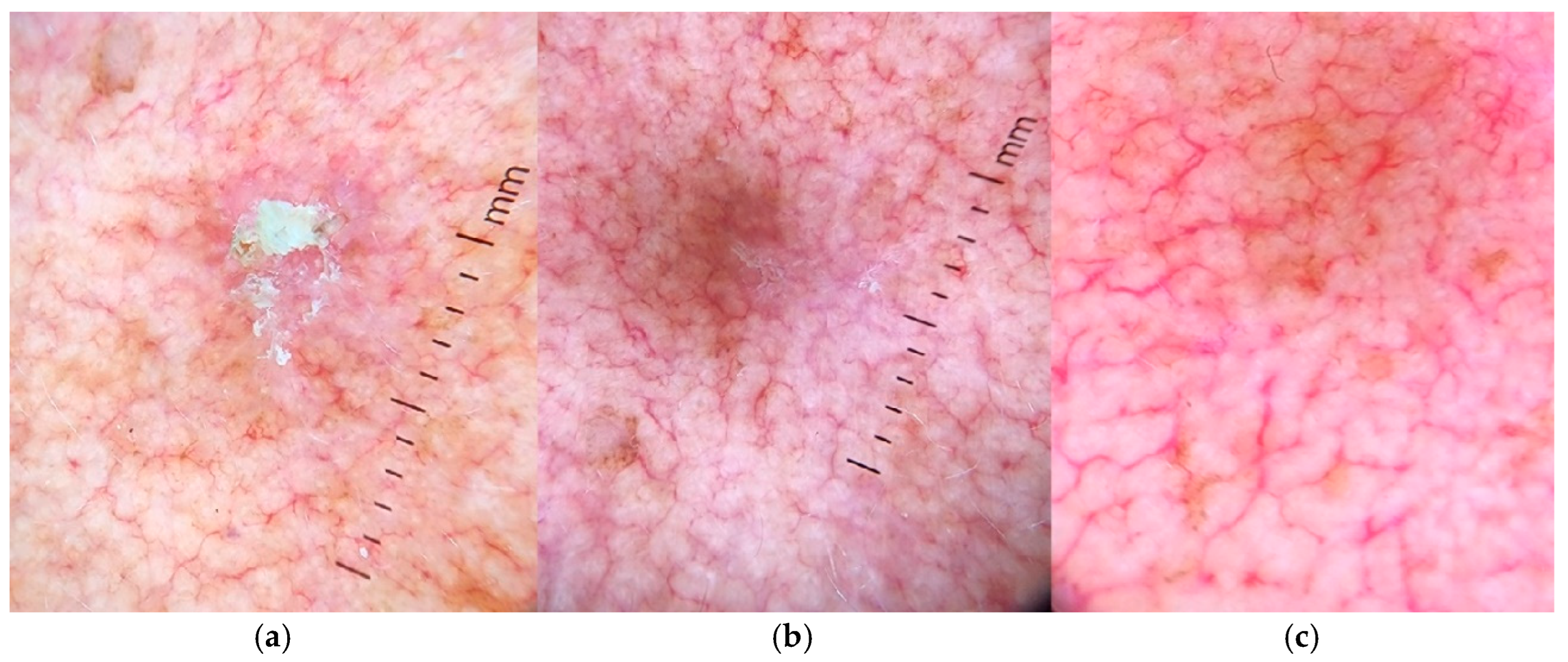 Dermato 05 00002 g002