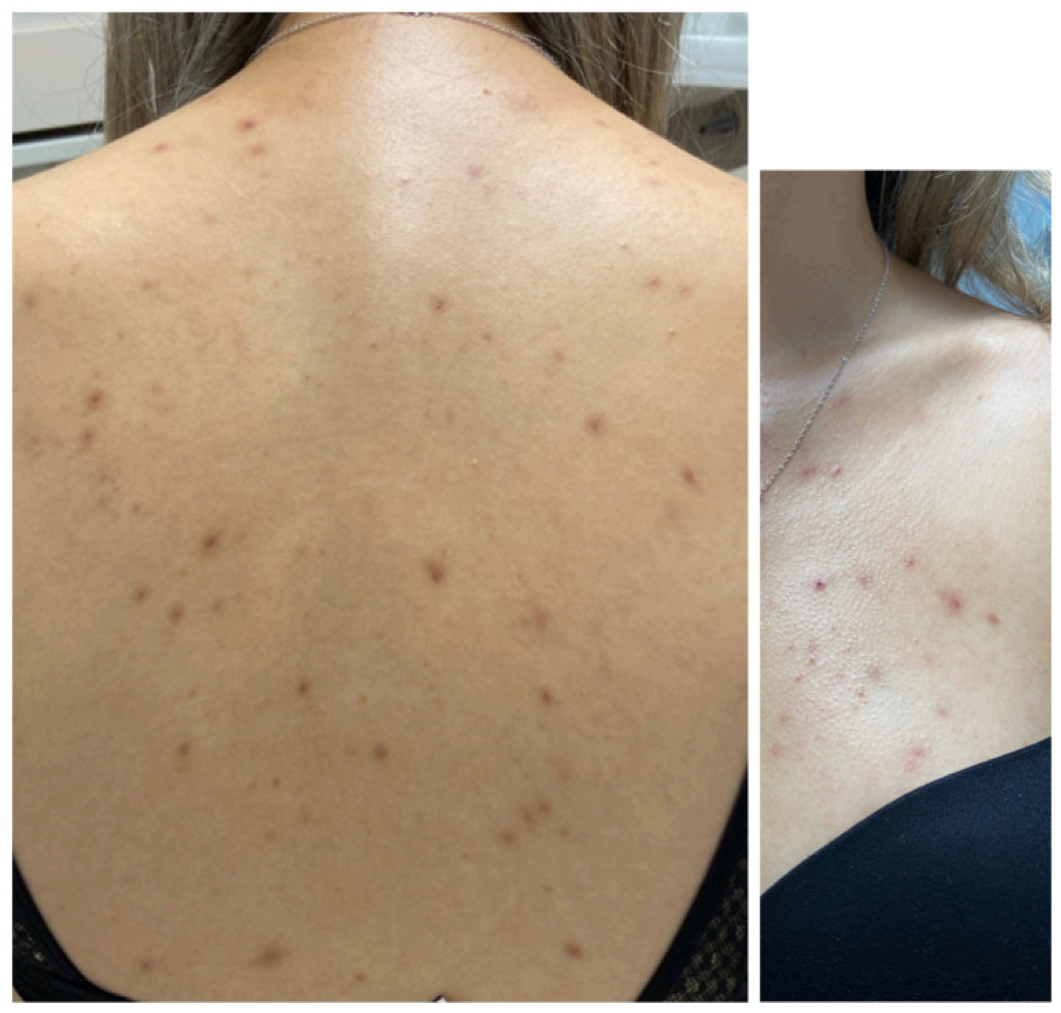 Dermato 05 00010 g002