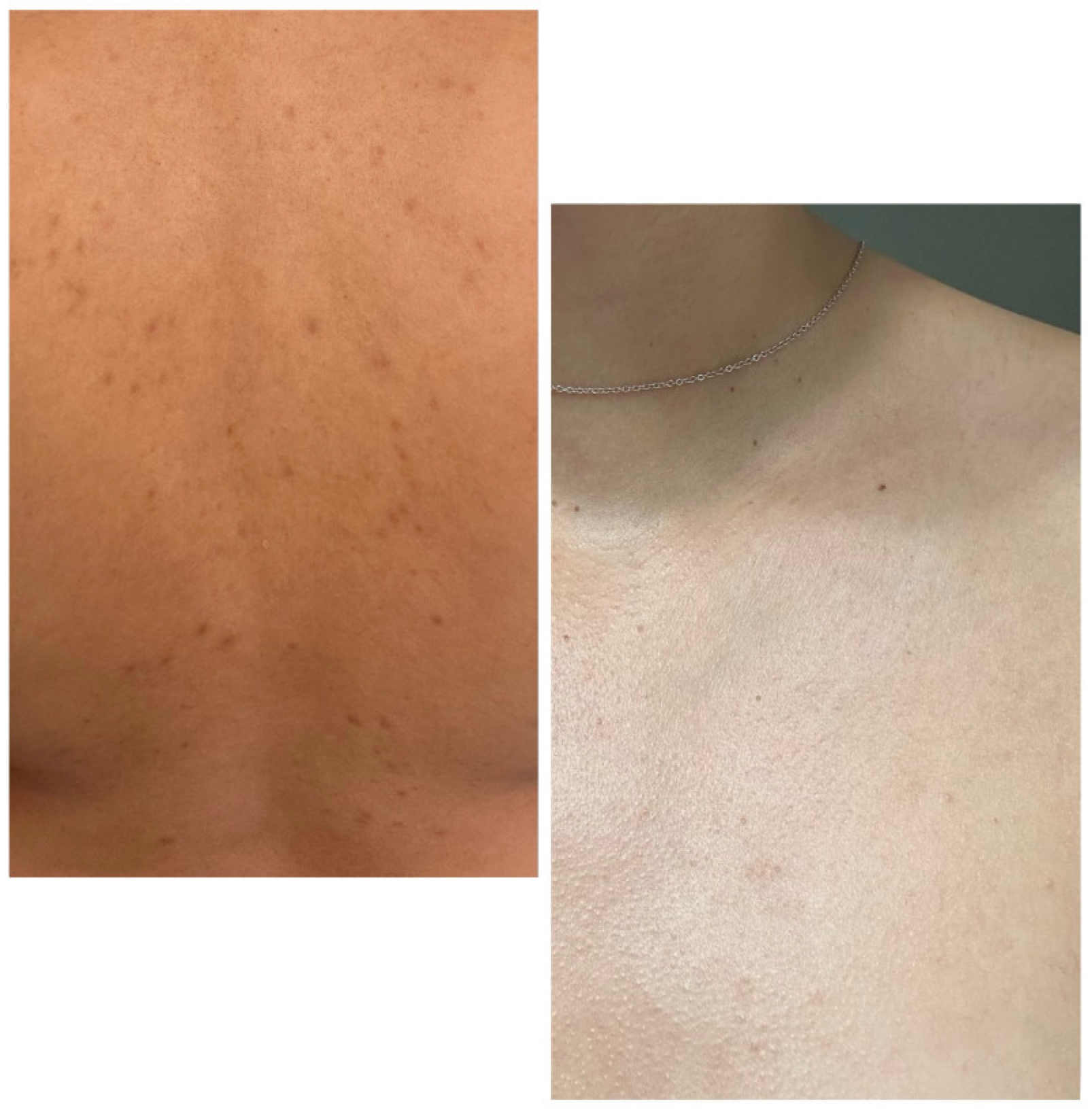 Dermato 05 00010 g003