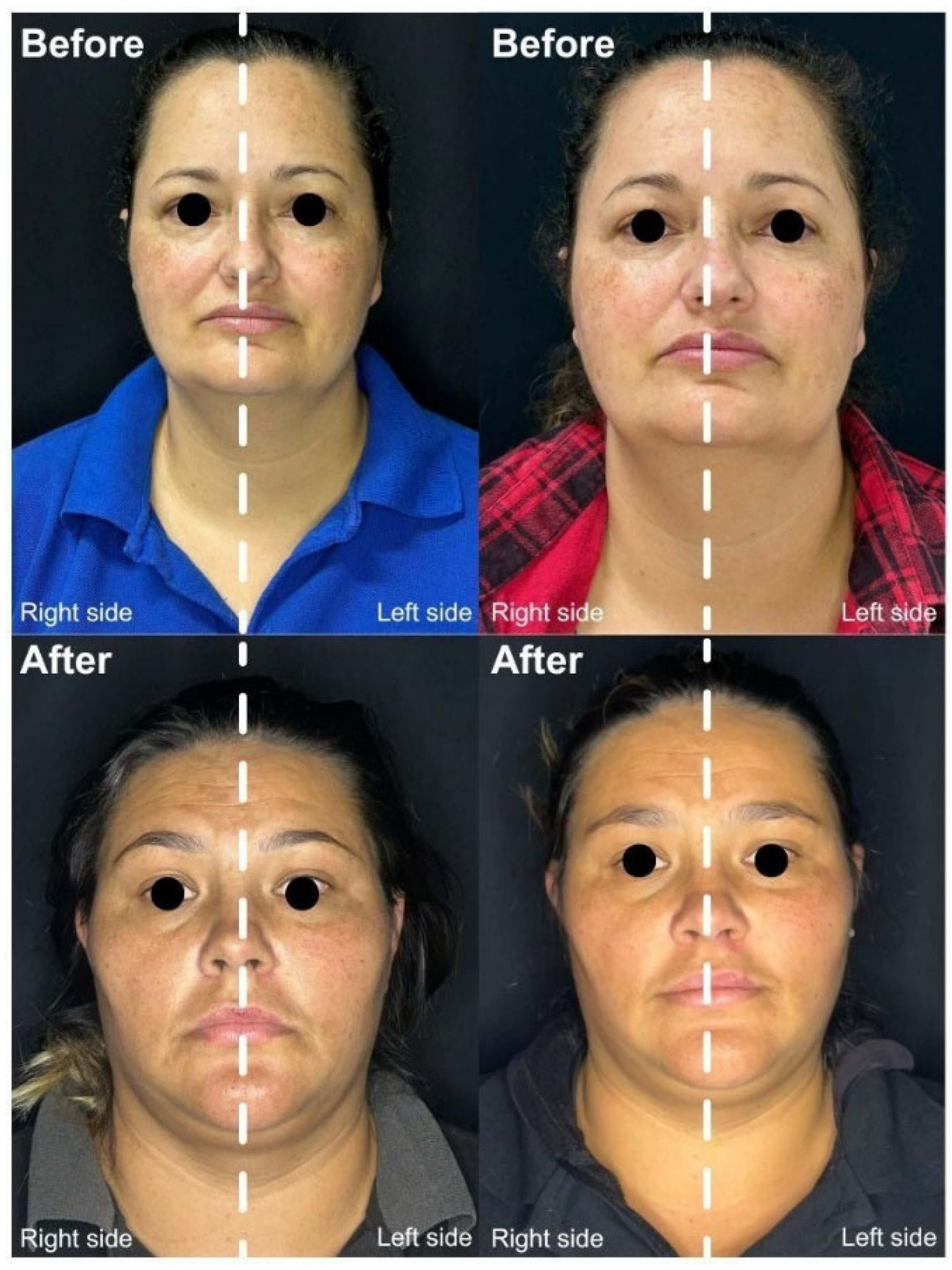 Dermato 05 00016 g003 Dermato 05 00016 g003