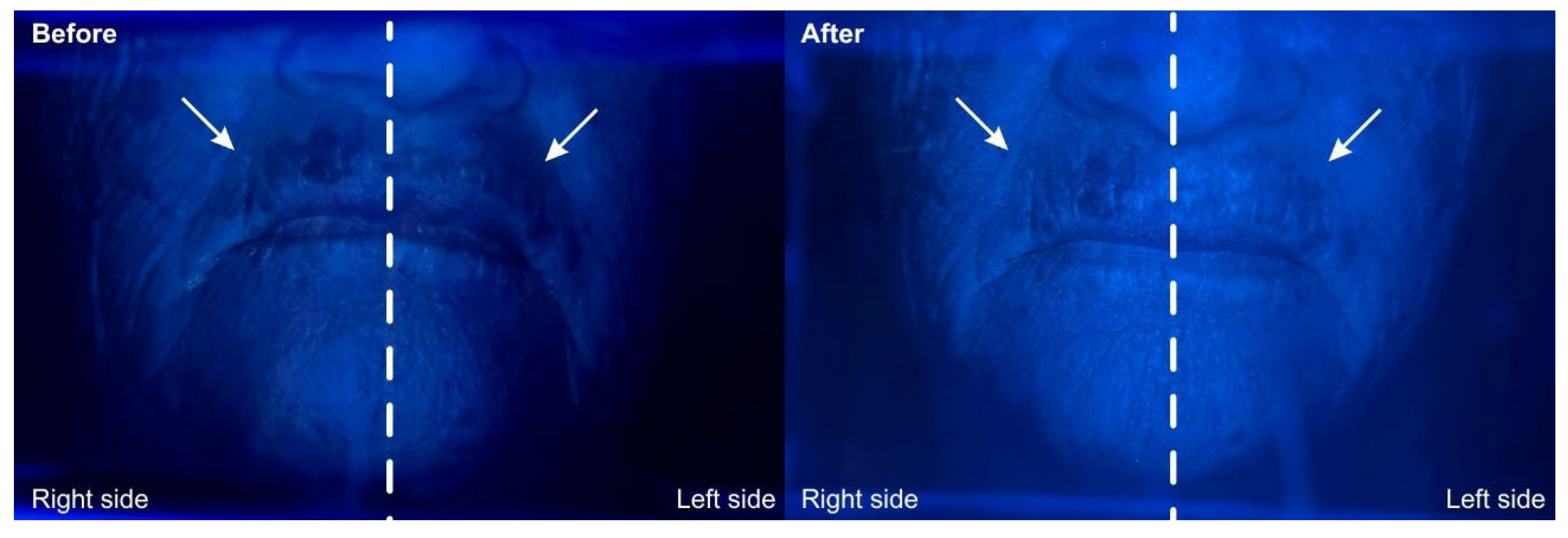 Dermato 05 00016 g004 Dermato 05 00016 g004