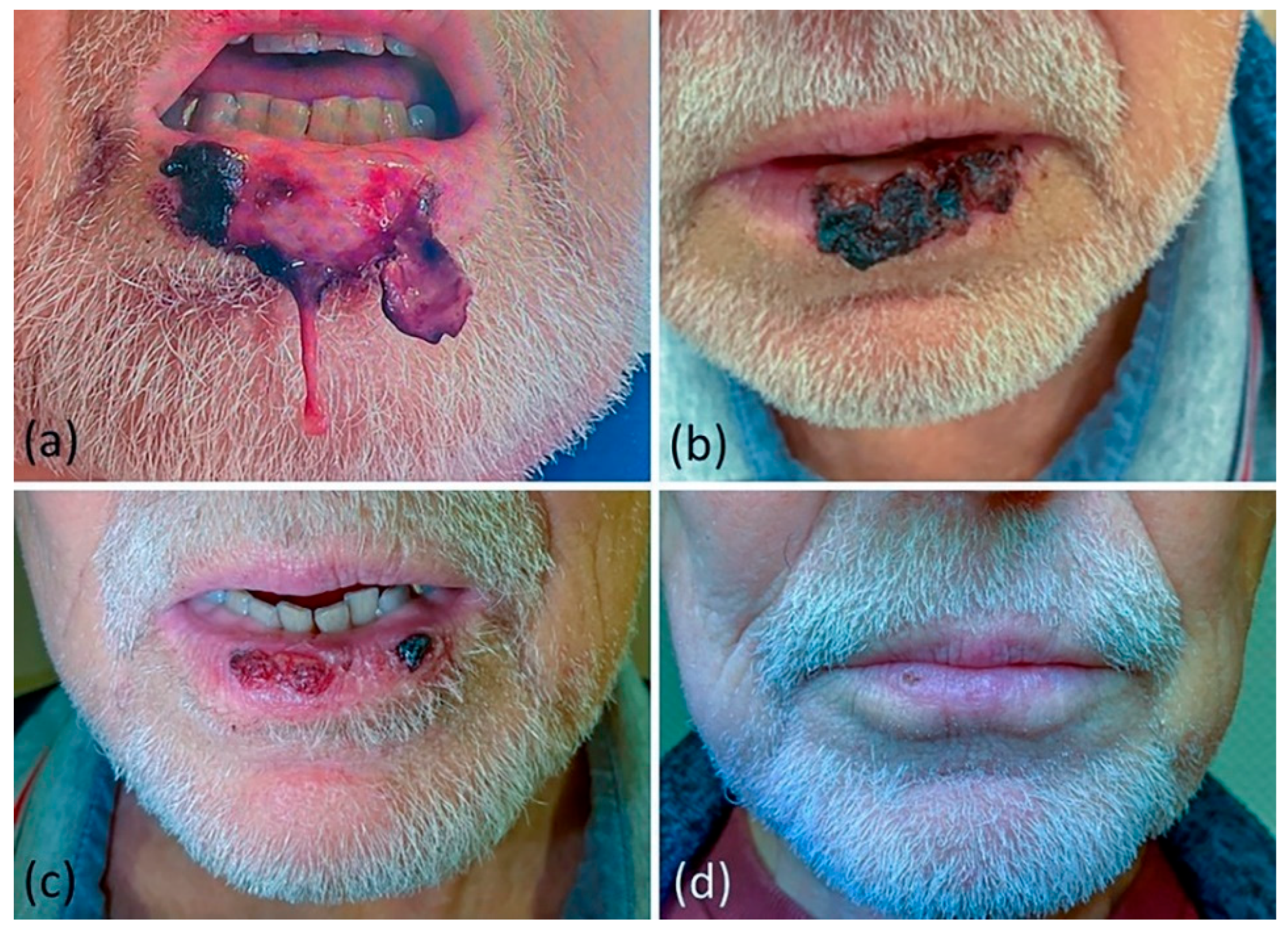 Dermato 05 00023 g001