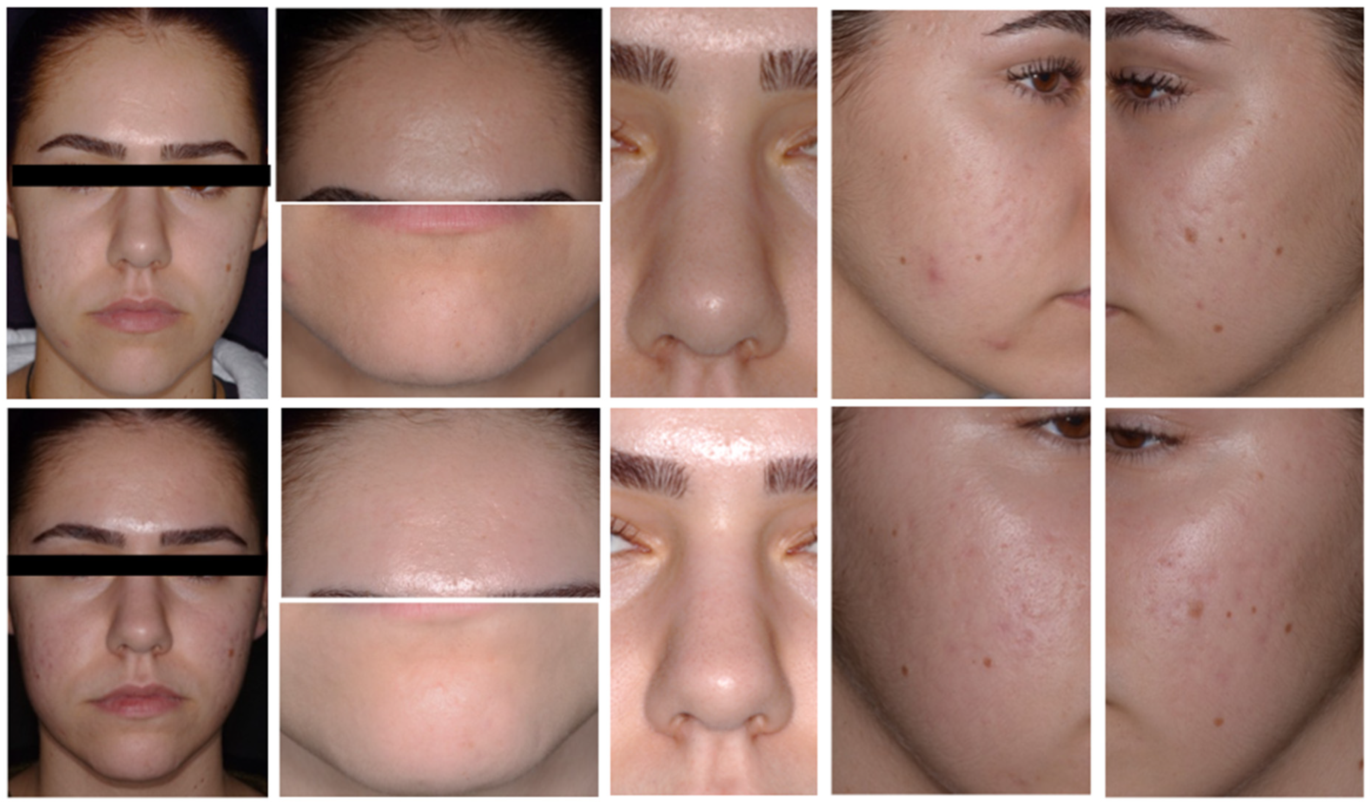 Dermato 06 00013 g004