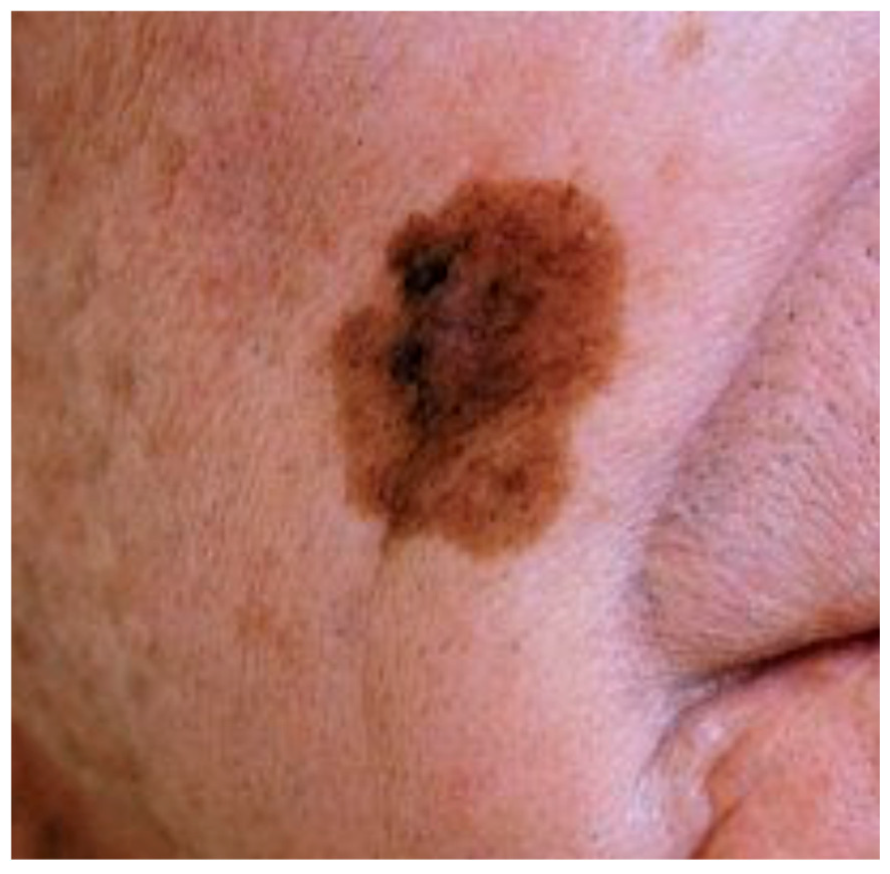 Dermato 06 00014 g003