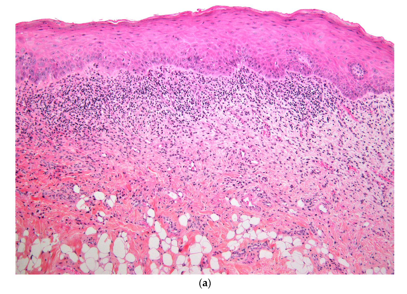 Dermatopathology 07 00004 g002a Dermatopathology 07 00004 g002a